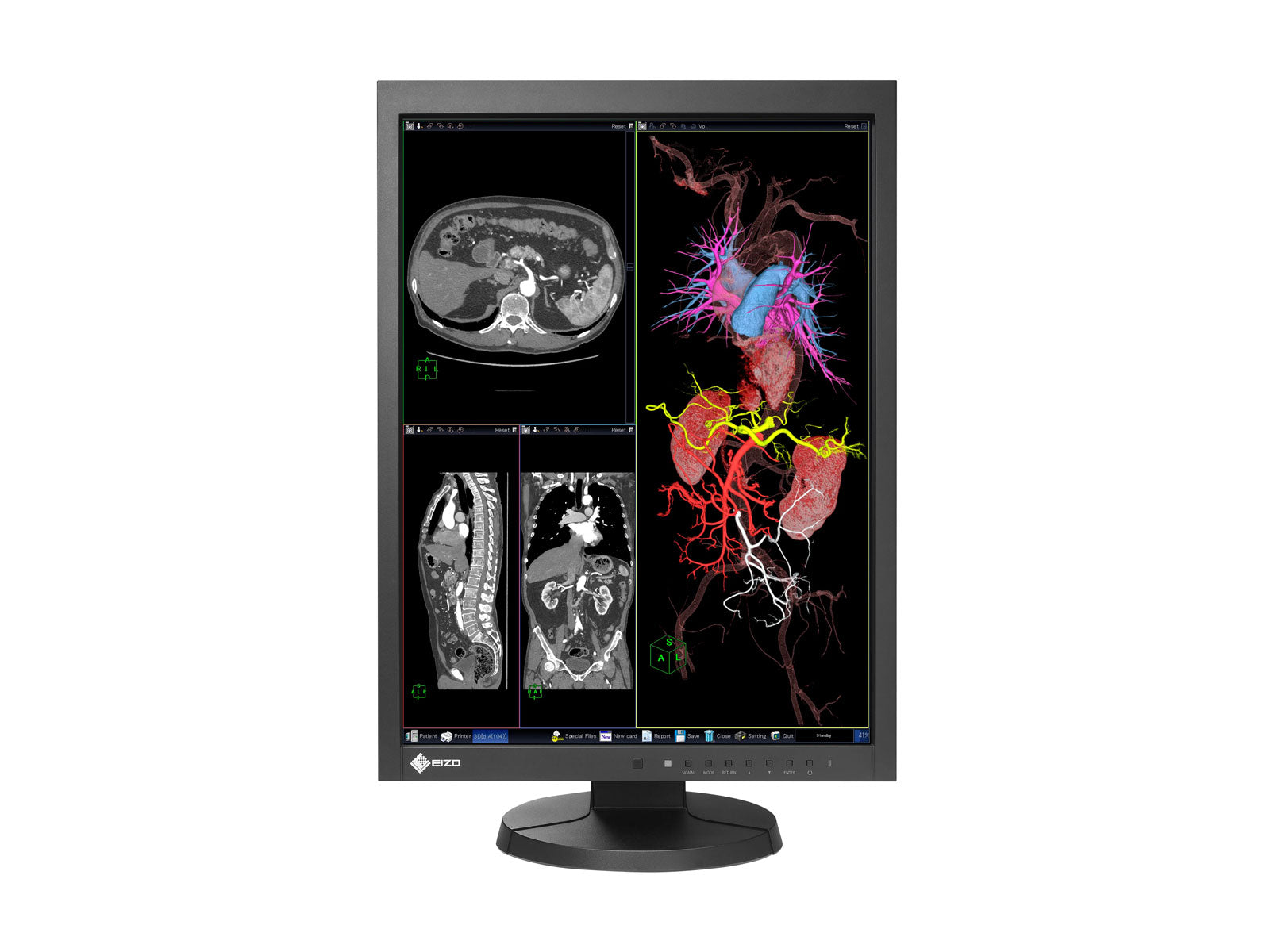 Eizo RadiForce MX215 2MP 2MP 21" Monitor de revisión clínica en color (MX215-BK)