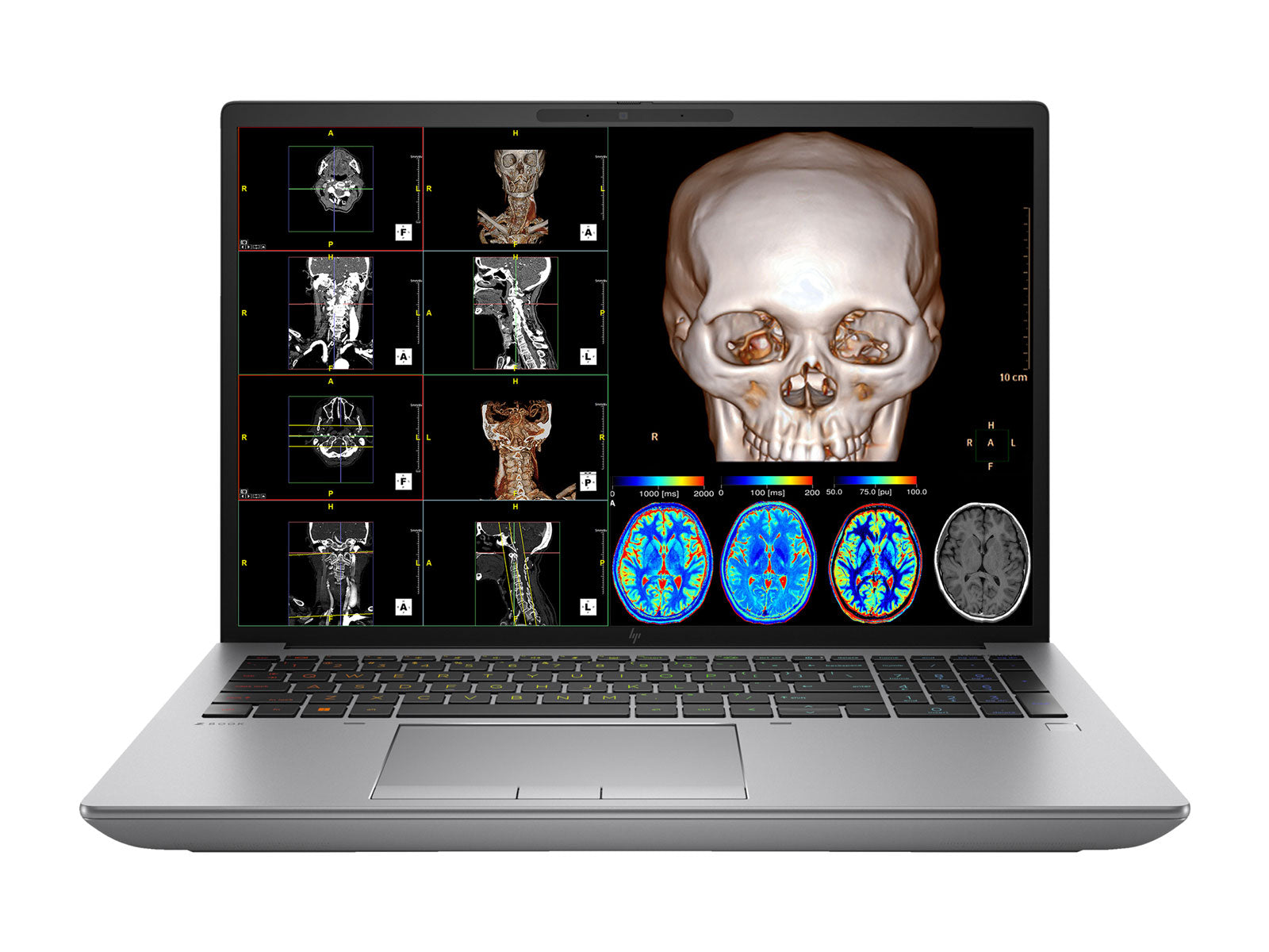 Estación de trabajo de radiología móvil HP ZBook Fury 16 G10 | DICOM UHD 4K+ de 16" y 9MP calibrado | Núcleo i9-13950HX @ 5.50GHz | 24 núcleos | 128 GB de memoria DDR5 | SSD NVMe de 1 TB | RTX 3500 Ada 12GB | WiFi 6E | Win10-11 A favor