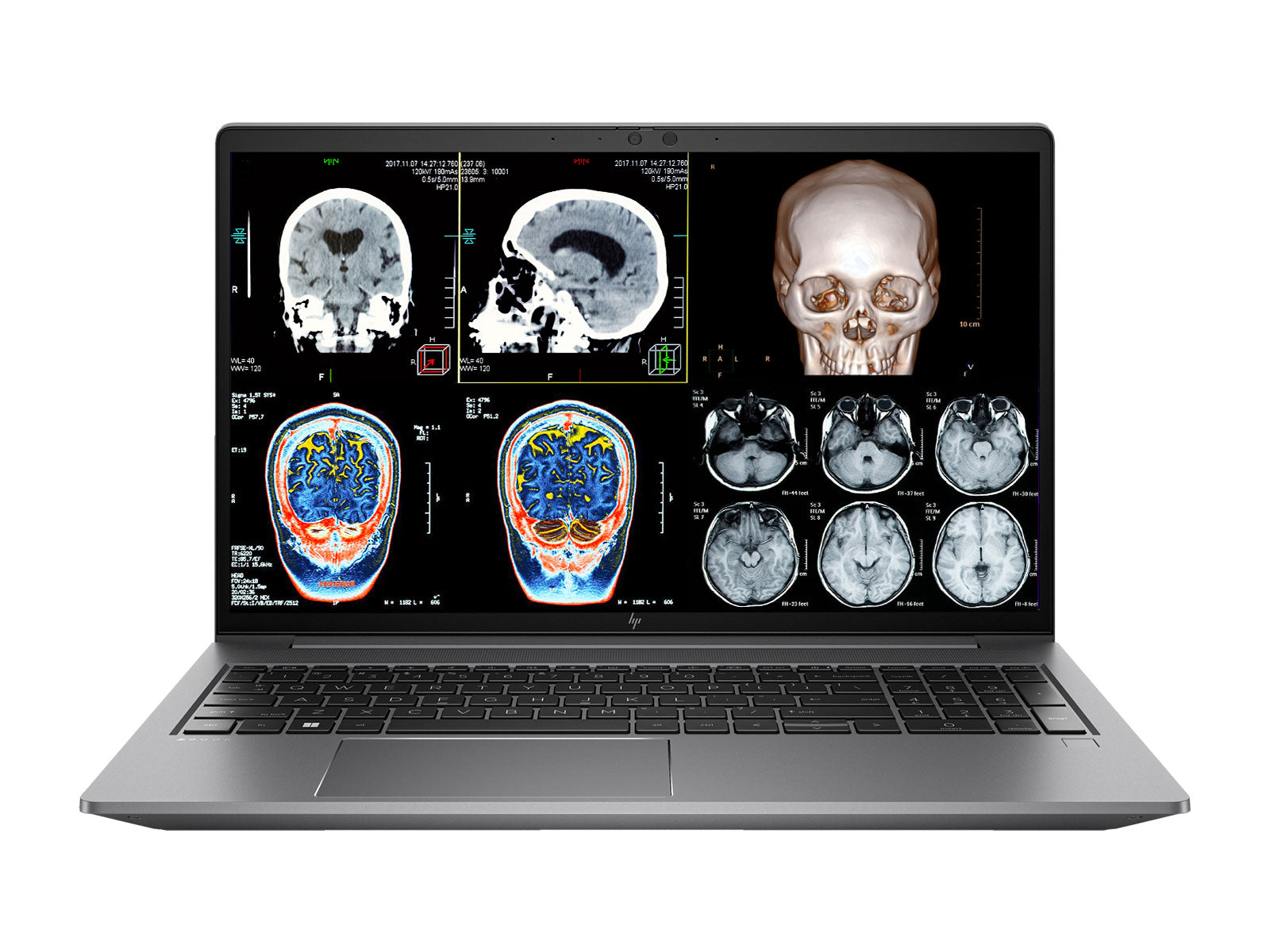 HP Potencia de ZBook G10 Estación de trabajo móvil | Calibrado FHD DICOM de 15,6" | Intel i7-13800H @ 5.20GHz | 14-Core | 32GB DDR5 | 512GB SSD NVMe | NVIDIA RTX A500 4GB