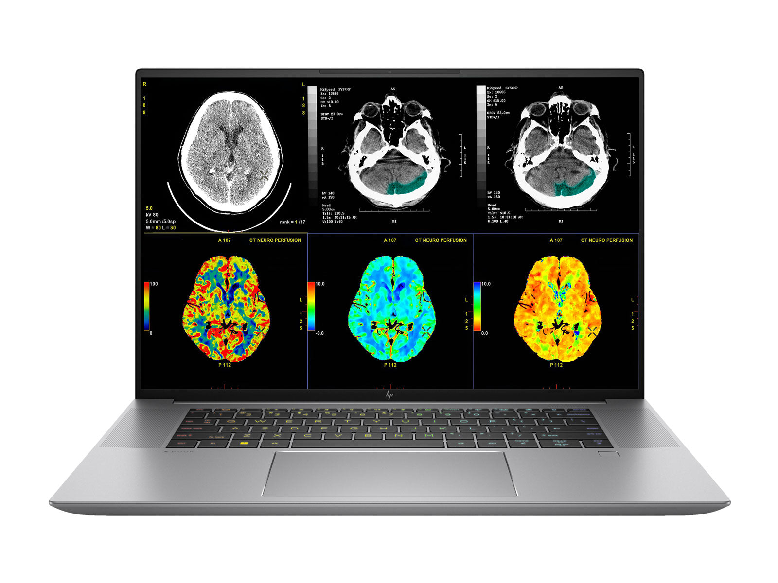 HP ZBook Studio 16 G10 Estación de trabajo móvil de radiología | 16" 9MP 4K UHD DICOM calibrado | Core i7-13700H @ 5.0GHz | 64GB DDR5 | 512GB SSD NVMe | Intel Iris Xe 4GB