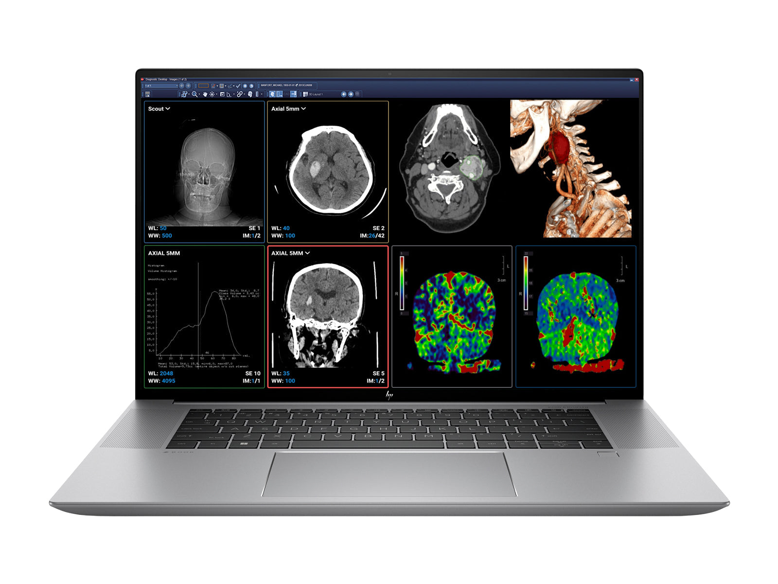 Estación de trabajo de radiología móvil HP ZBook Studio 16 G9 | WUXGA DICOM de 16" calibrado | Núcleo i7-12700H @ 4.70GHz | 14 núcleos | DDR5 de 64 GB | SSD NVMe de 1 TB | Intel Iris Xe 4GB | WiFi 6 | Win10-11 A favor