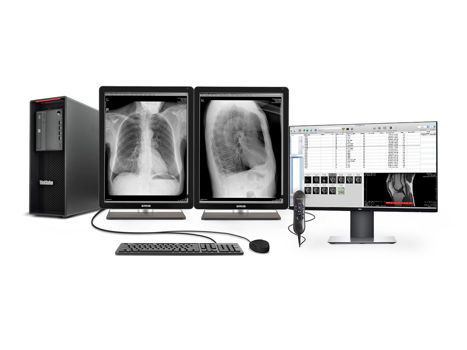 Estación de radiología general completa PACS | Barco 3MP Pantallas LED en escala de grises | Lenovo Estación de trabajo | Micrófono de dictado | Monitor de lista de trabajo (3221Z4R)
