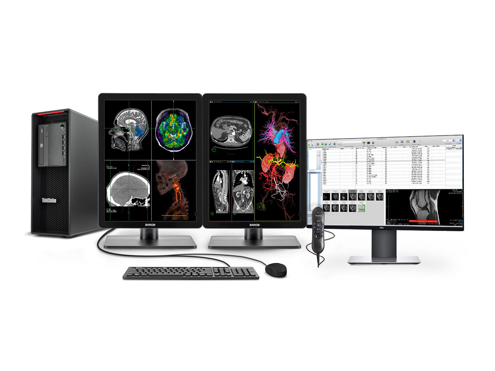 Estación de radiología general completa PACS | Barco 3MP Pantallas LED a color | Lenovo Estación de trabajo | Micrófono de dictado | Monitor de lista de trabajo (3421Z4R)