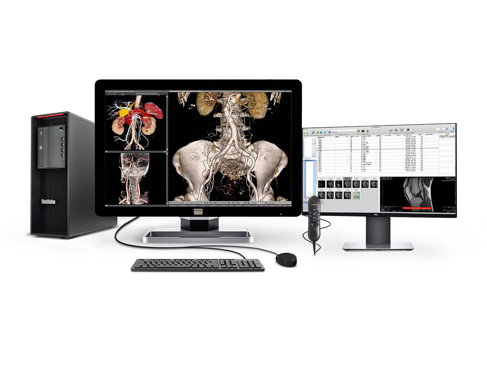 Estación de radiología general completa PACS | Barco 6MP Pantalla LED a color | Lenovo Estación de trabajo | Micrófono de dictado | Monitor de lista de trabajo (6230Z4R)