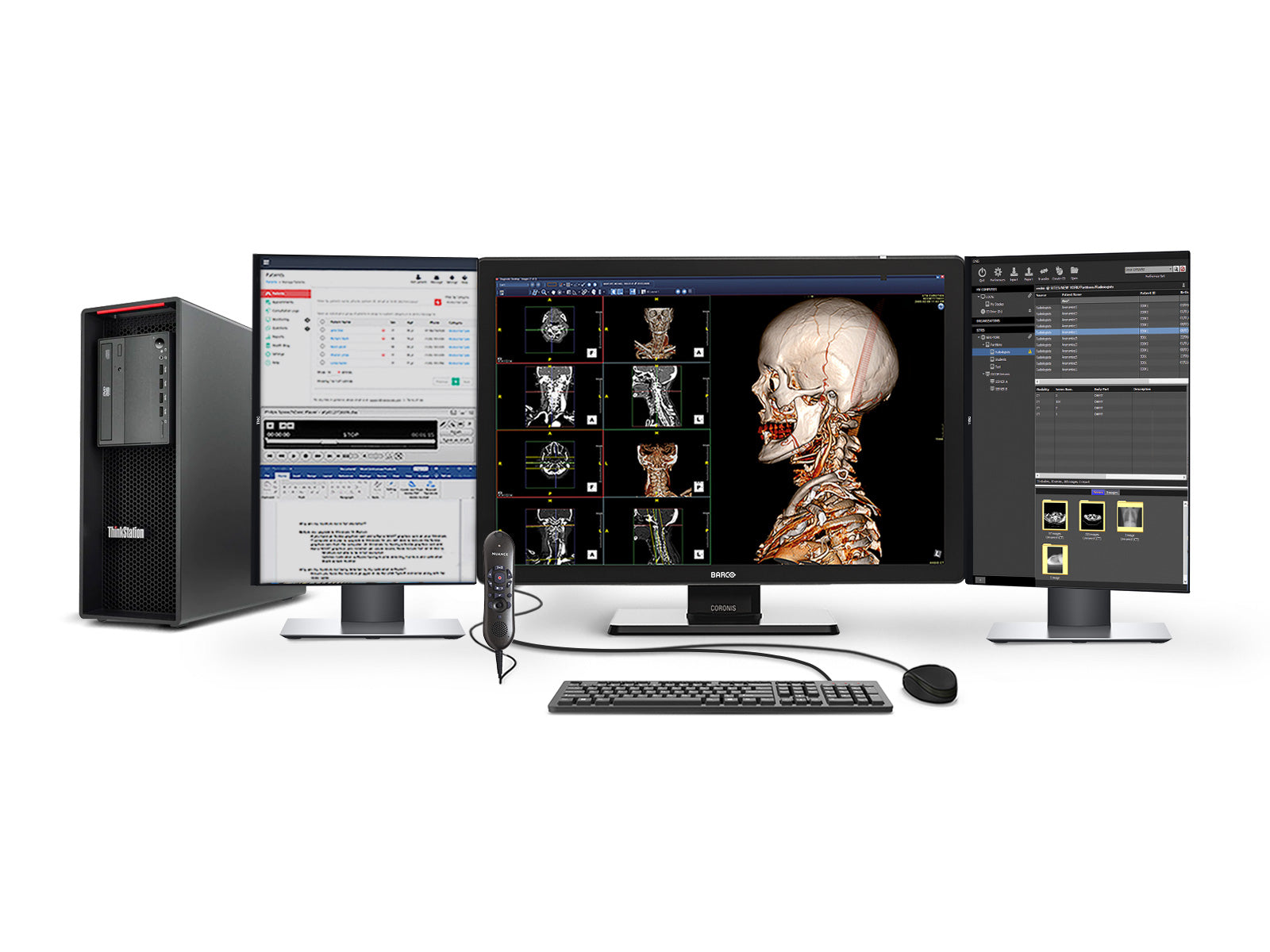 Complete PACS General Radiology Station | Barco Coronis MDCC-6530 6MP Color LED Display | Lenovo Workstation | Dictation Mic | Worklist Monitor (6530Z4R)