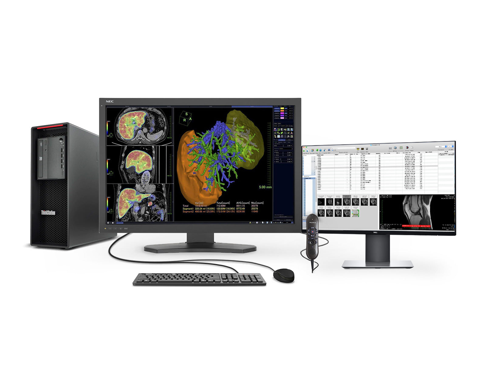 Estación de radiología general completa PACS | NEC 6MP Pantalla LED a color | Lenovo Estación de trabajo | Micrófono de dictado | Monitor de pool de trabajo (MD302C6Z4)