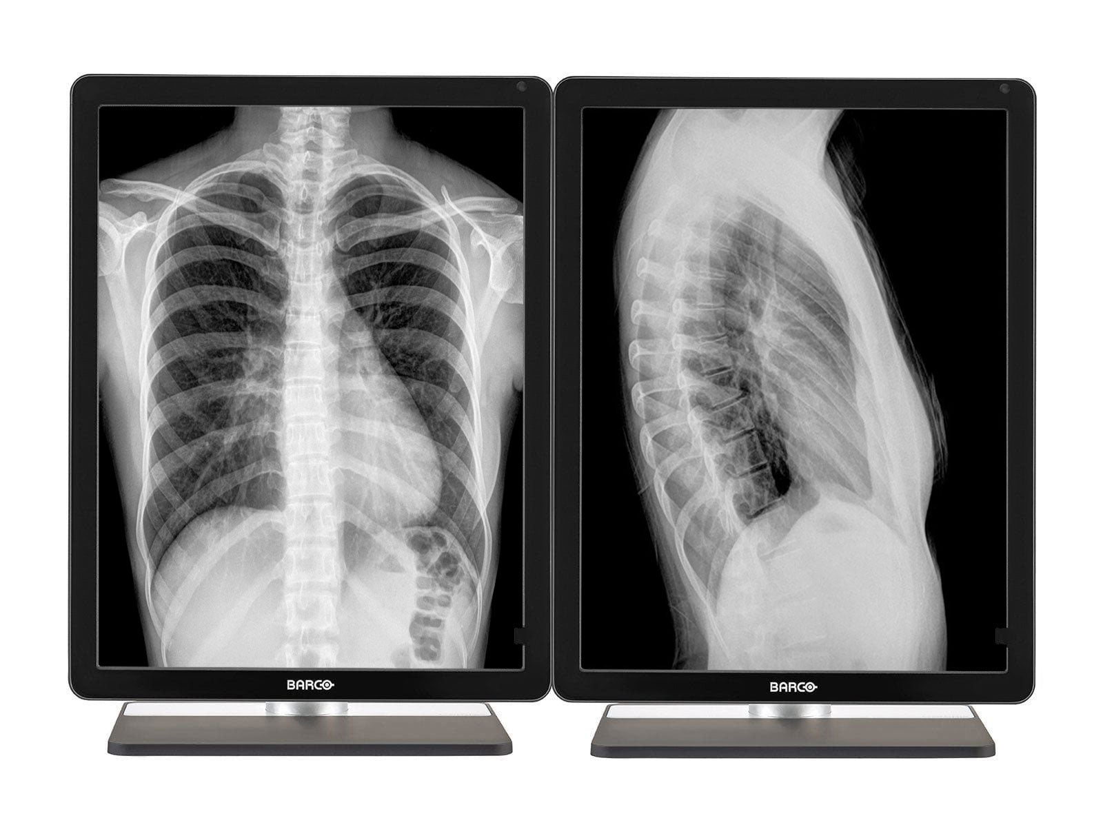 Barco Coronis MDCG-3221 3MP 21" LED en escala de grises Pantalla de diagnóstico de radiología general