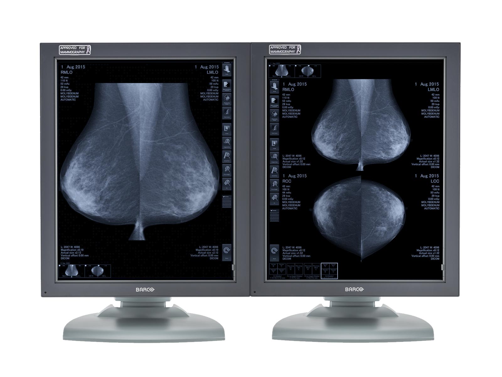 Barco Coronis MDMG-5121 5MP 21" Pantalla de mamografía PACS de imágenes de mama en escala de grises