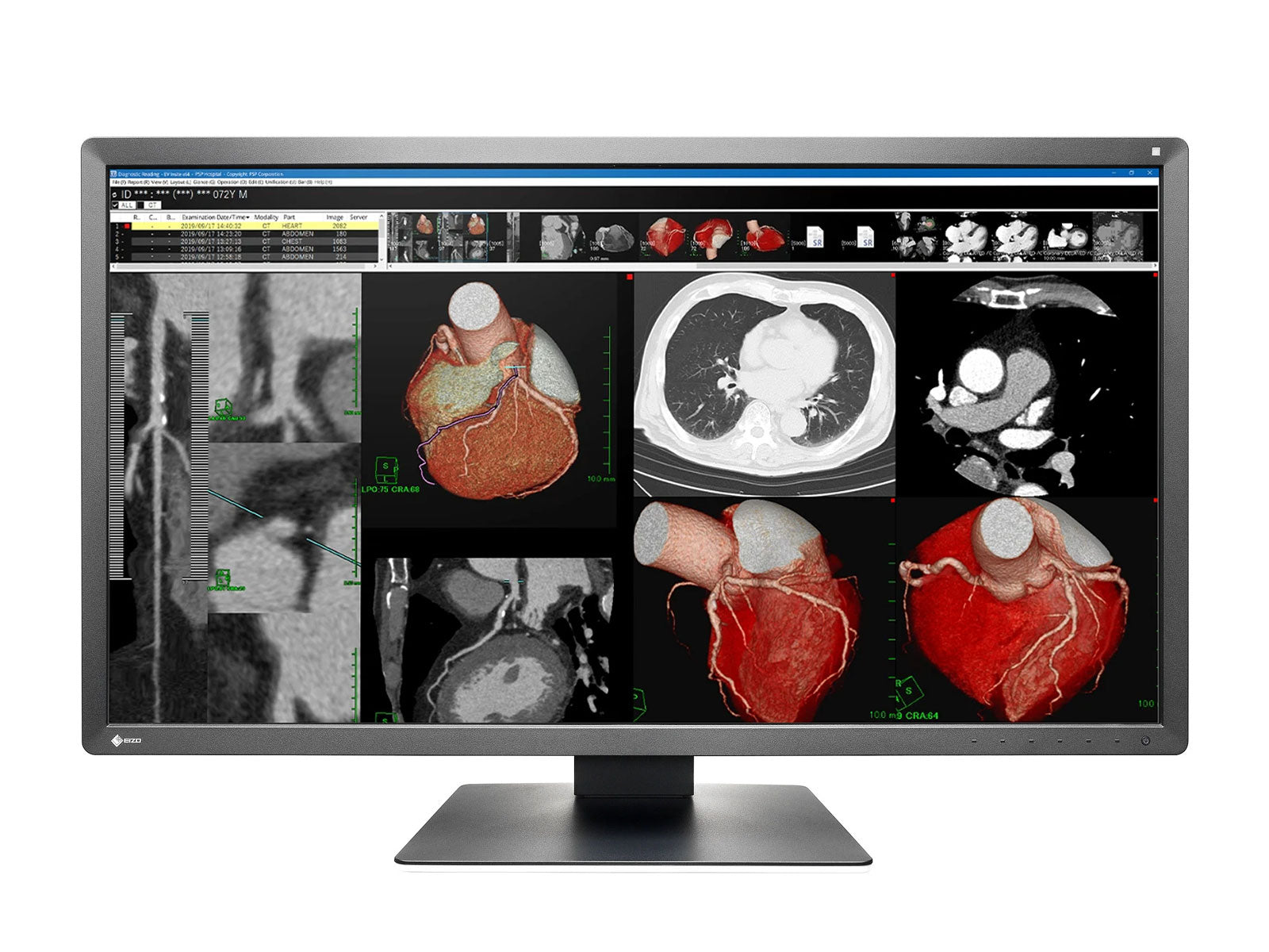 Monitor de revisión clínica a color Eizo RadiForce MX317W de 8MP y 30" (MX317W-BK)