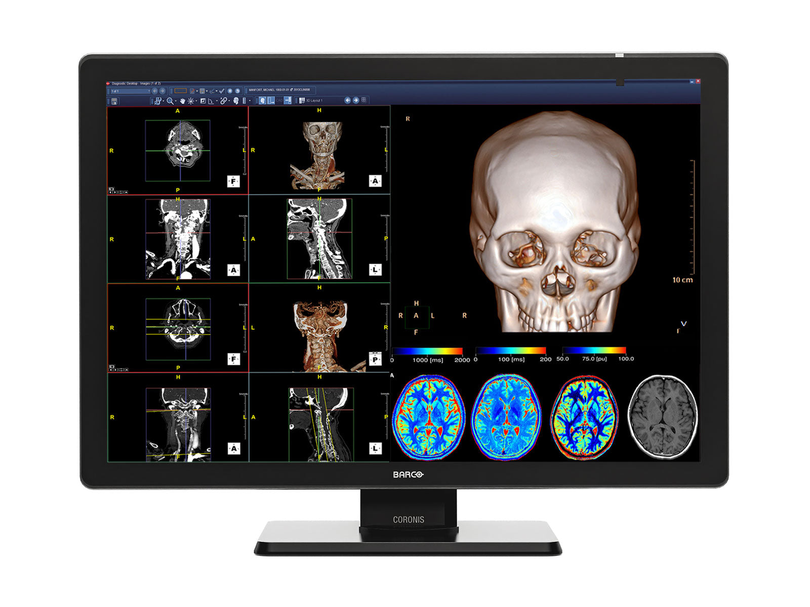 Barco Coronis Fusion MDCC-4430 4MP 30" LED Color Pantalla PACS de diagnóstico médico