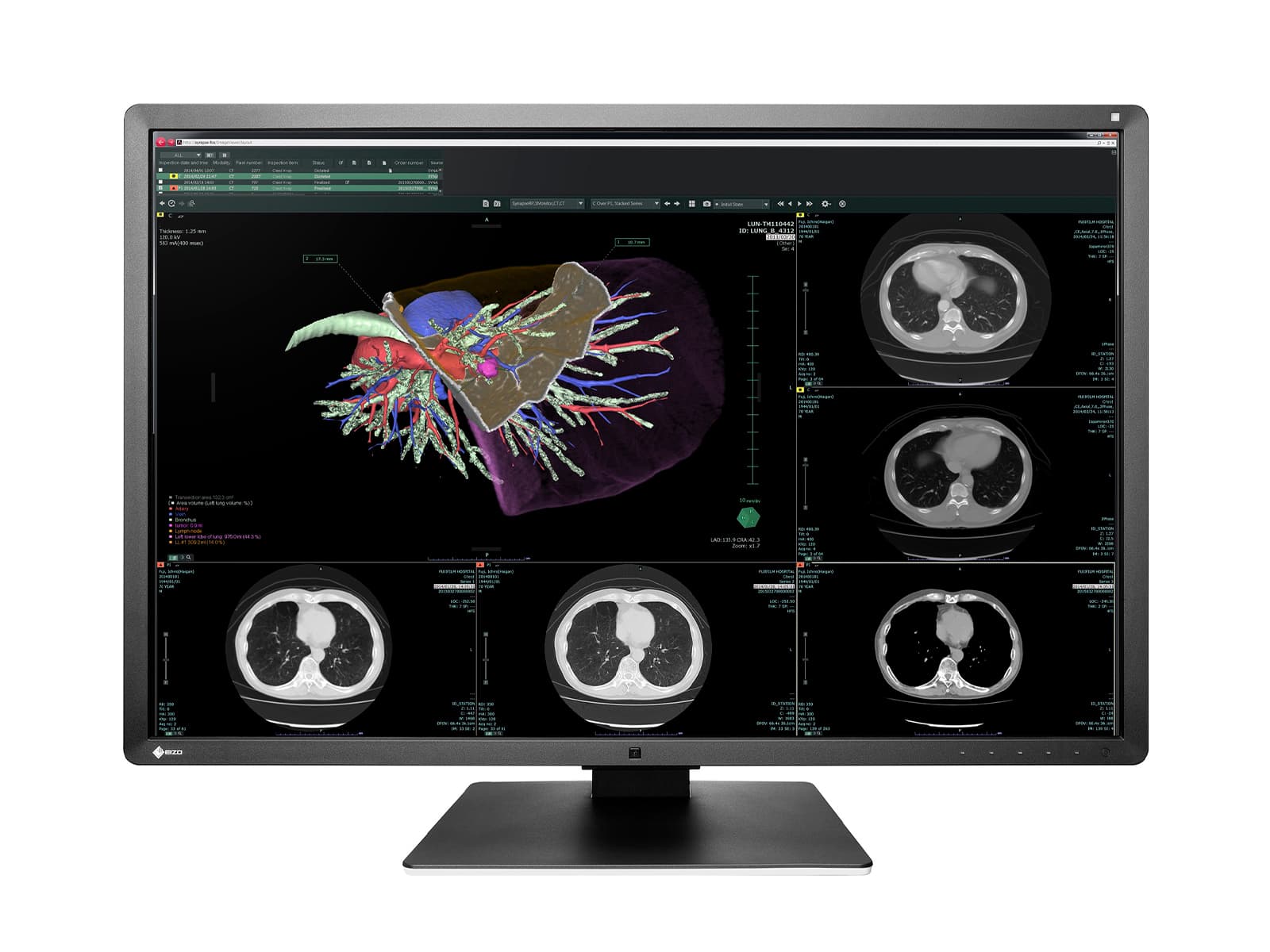 Eizo RadiForce RX660 6MP 30" LED a color Radiología General Pantalla PACS (RX660-AR)