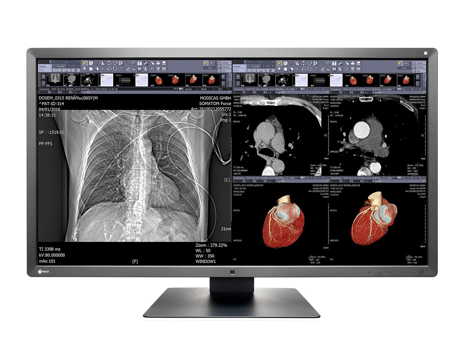 Monitor de revisión clínica a color Eizo RadiForce MX315W de 8MP y 31" (MX315W-BK)