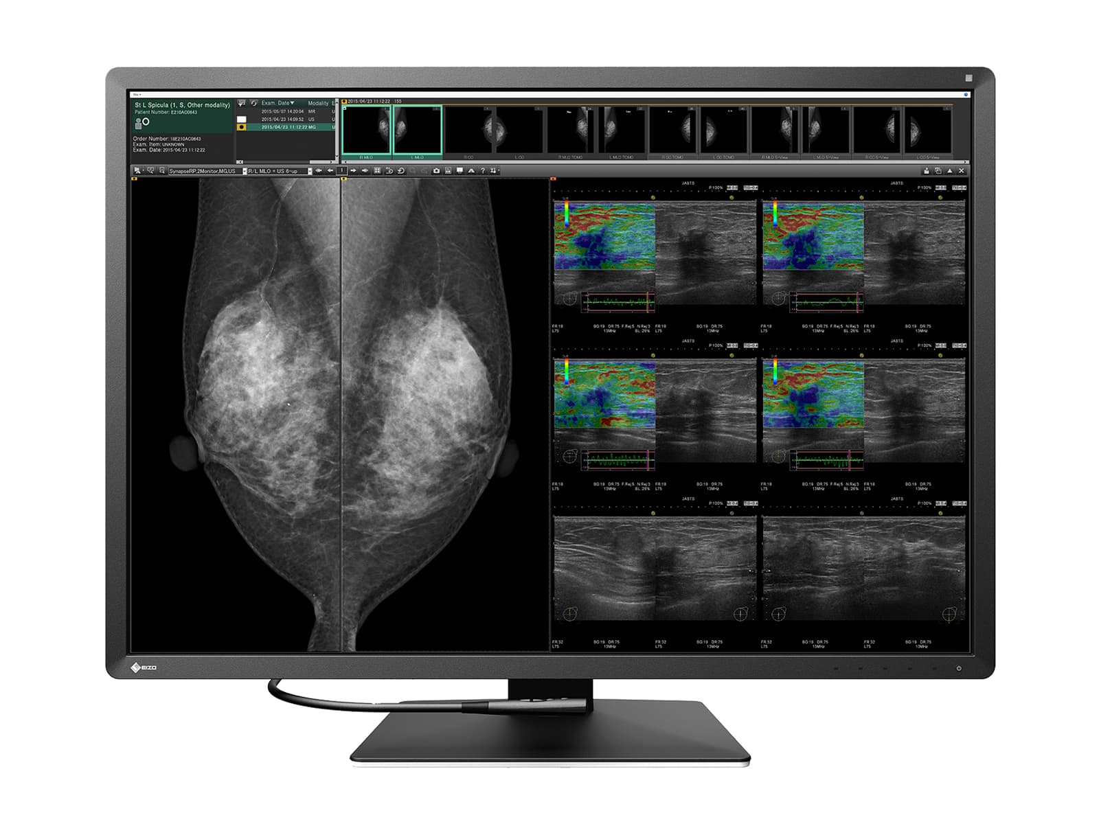 Eizo Radiforce RX1270 12MP 31" Tomo Color LED Mammo 3D DBT PACS Display (RX1270)