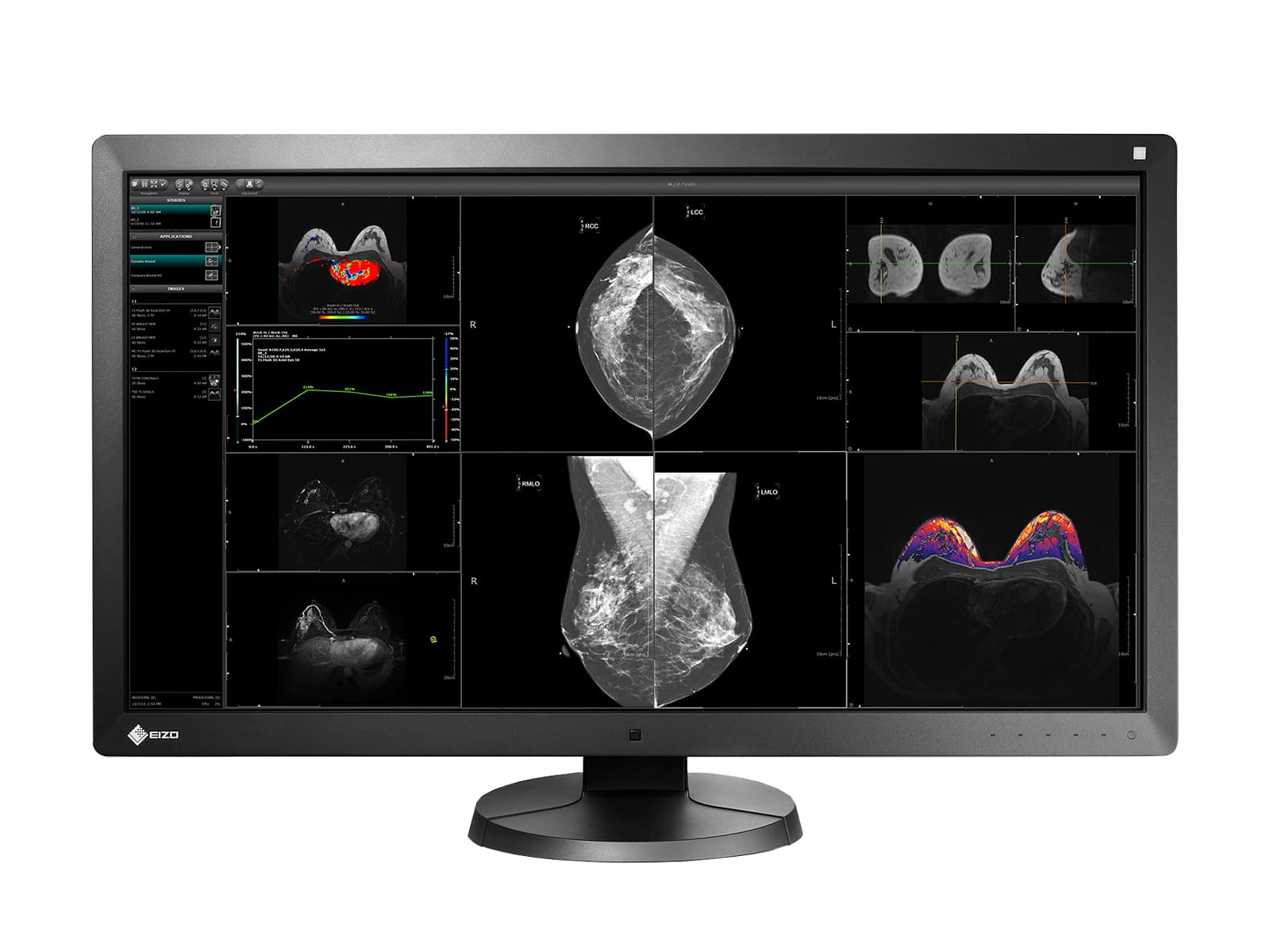 Eizo RadiForce RX850 8MP 31" Fusion Color LED Mammo 3D-DBT Pantalla de imágenes de mama (RX850-BK)