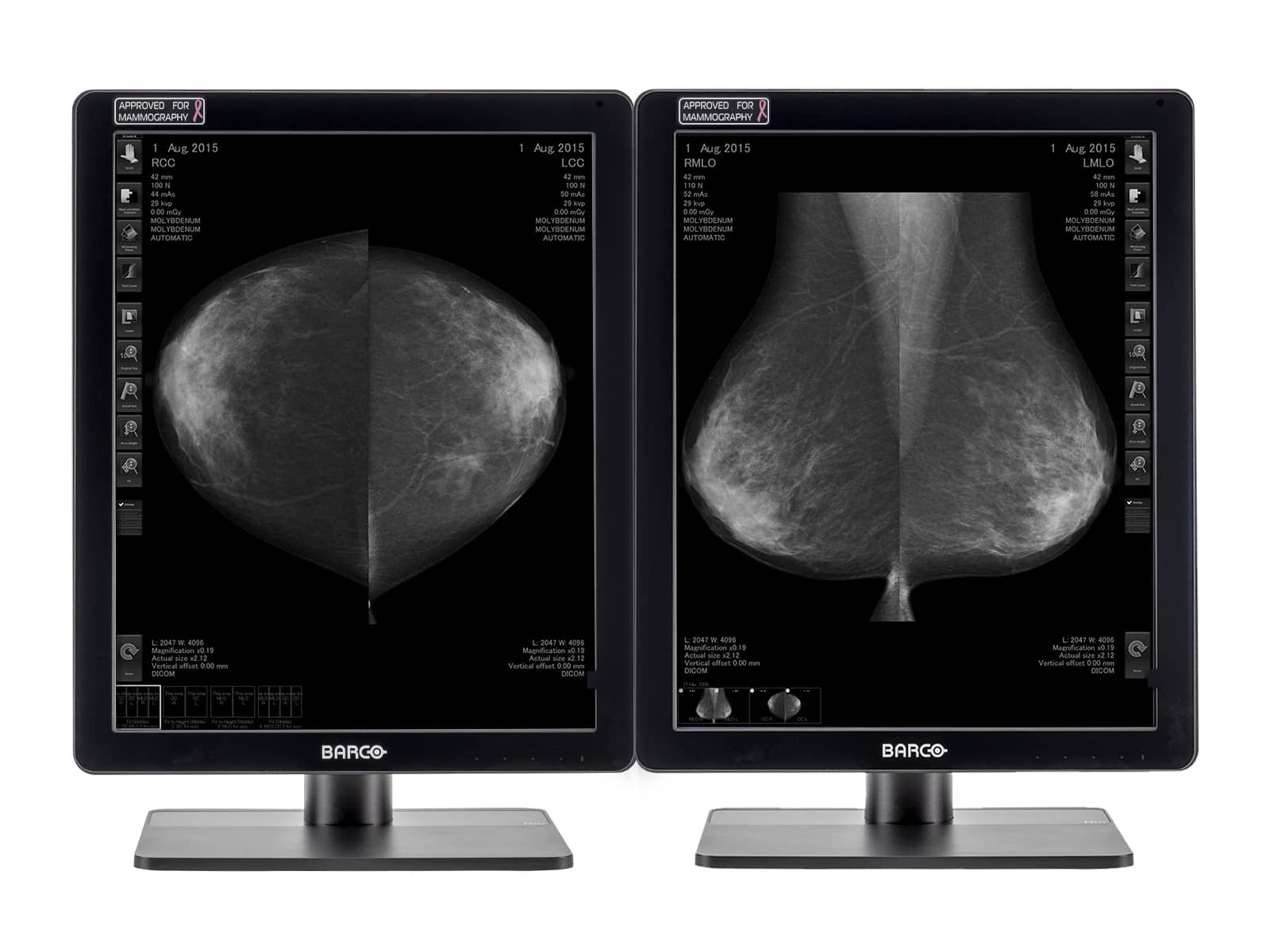 Barco Coronis MDCG-5221 5MP 21" Pantalla de imágenes de mama LED Mammo 3D-DBT en escala de grises
