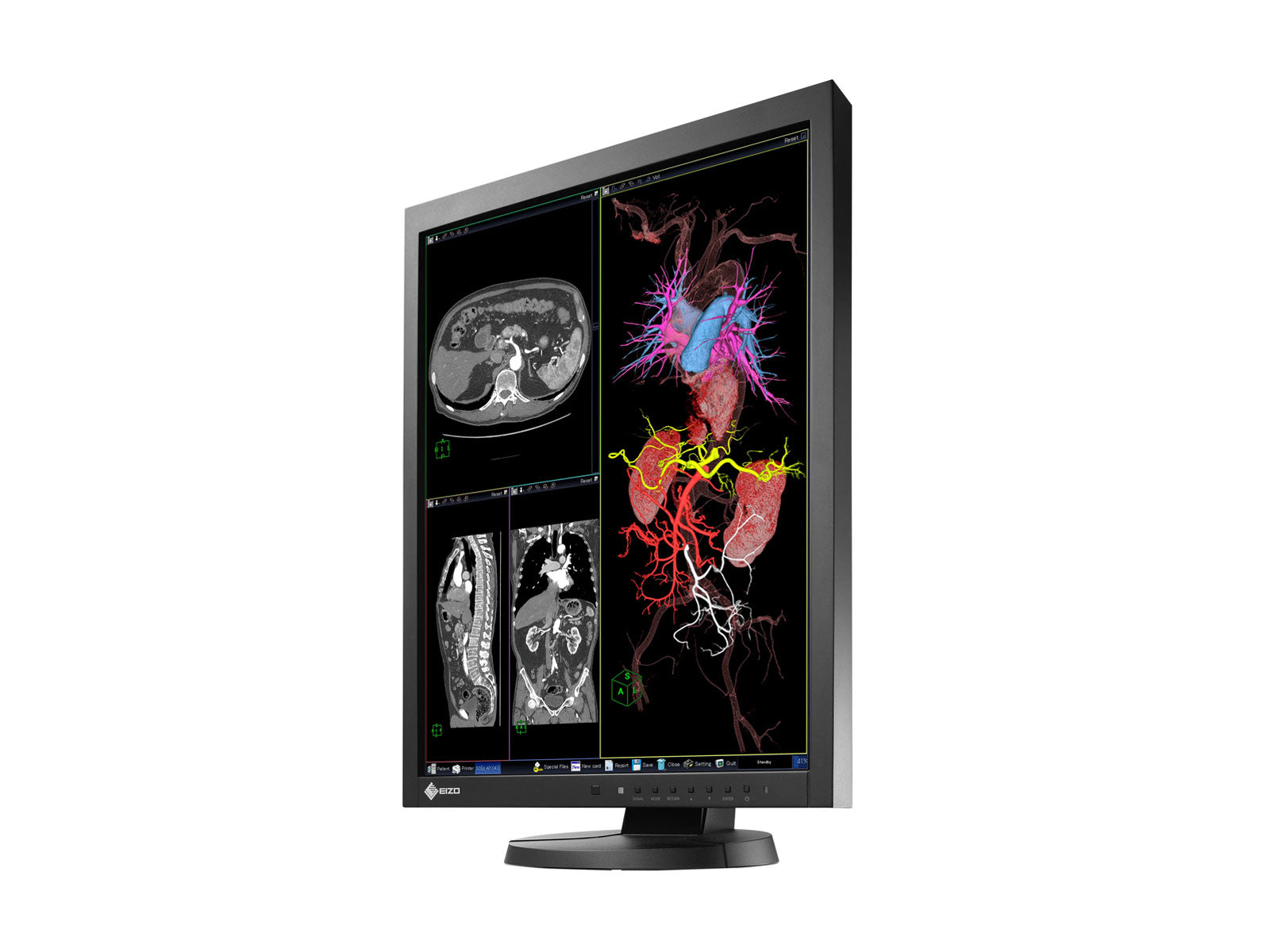 Eizo RadiForce MX215 2MP 21" Color Clinical Review Display Monitor (MX215-BK)