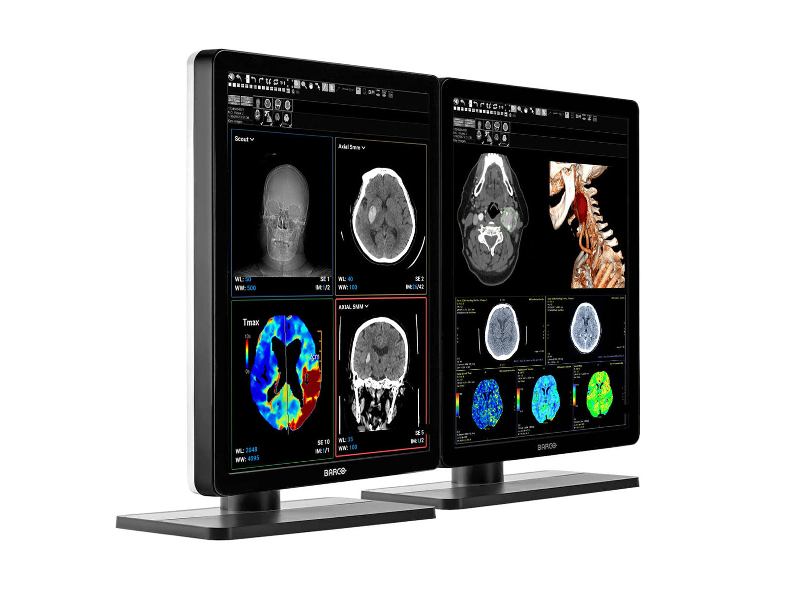 Barco Nio MDNC-3421 3MP 21" Color LED General Radiology PACS Display