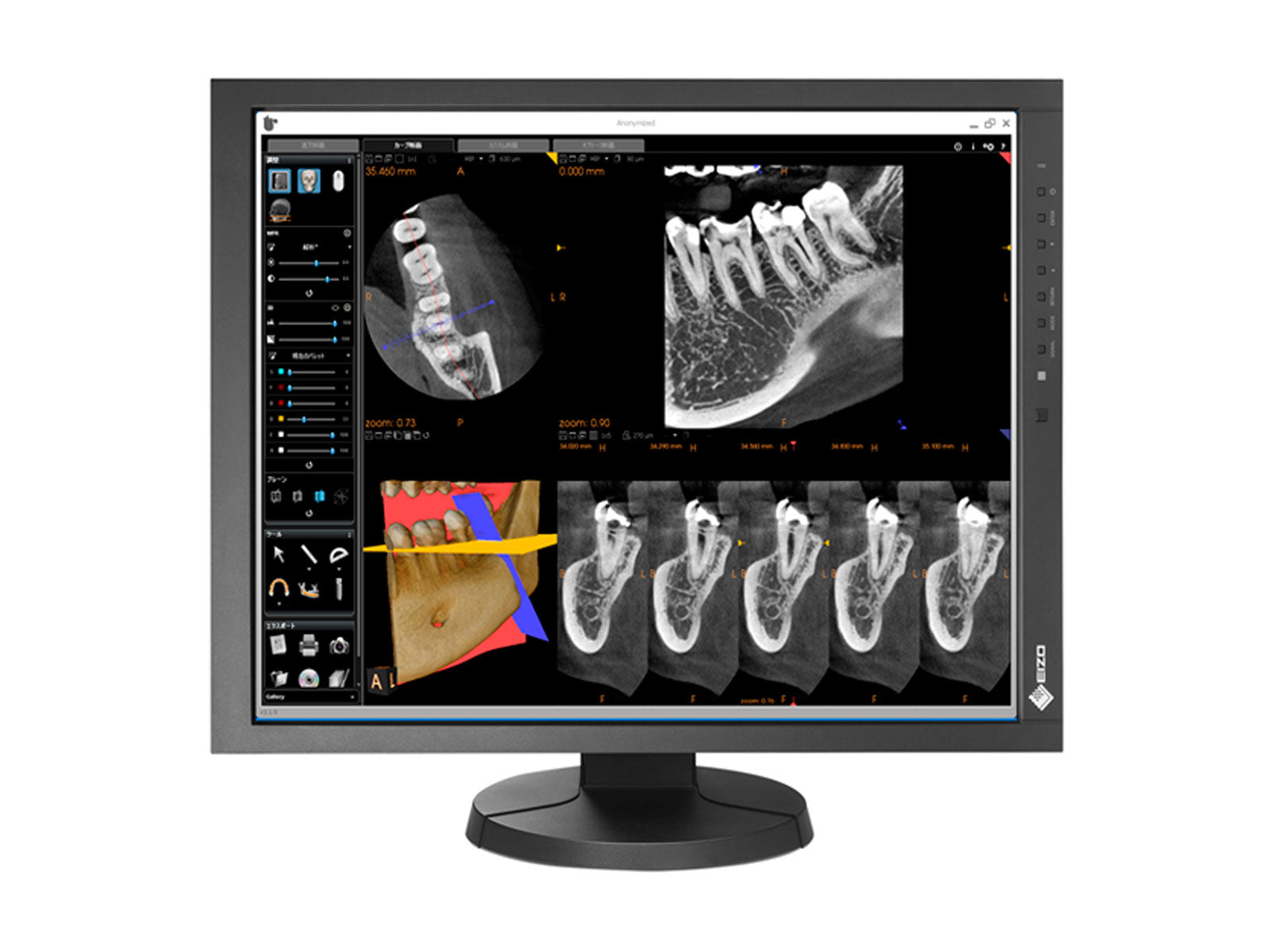 Eizo RadiForce MX215 2MP 21" Color Clinical Review Display Monitor (MX215-BK)