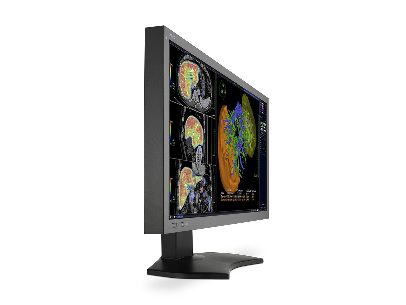 NEC MultiSync MD302C6 6MP 30" General Radiology PACS Display (MD302C6) Monitors.com 