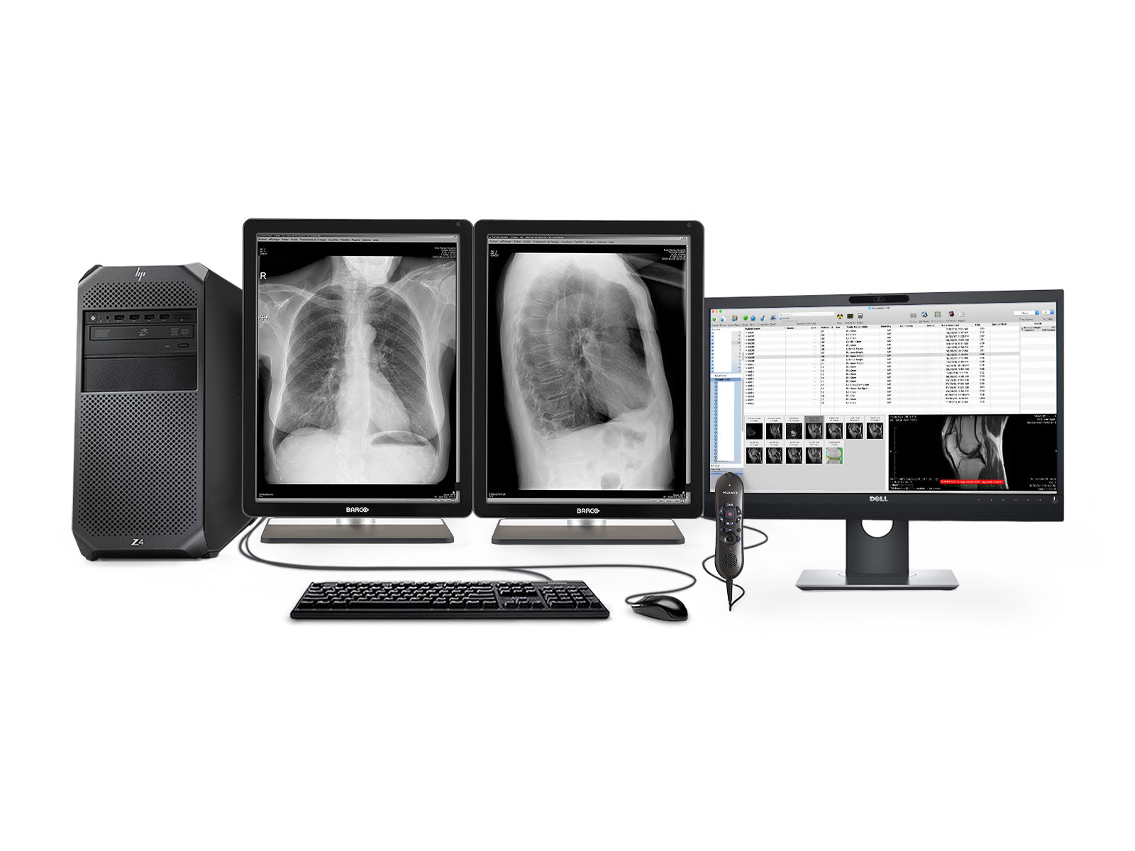 Pacs General Radiology Station | Barco 3MP 그레이 스케일 LED 디스플레이 | HP 워크 스테이션 | 독립 마이크 | 워크리스트 모니터 (3221Z4R)