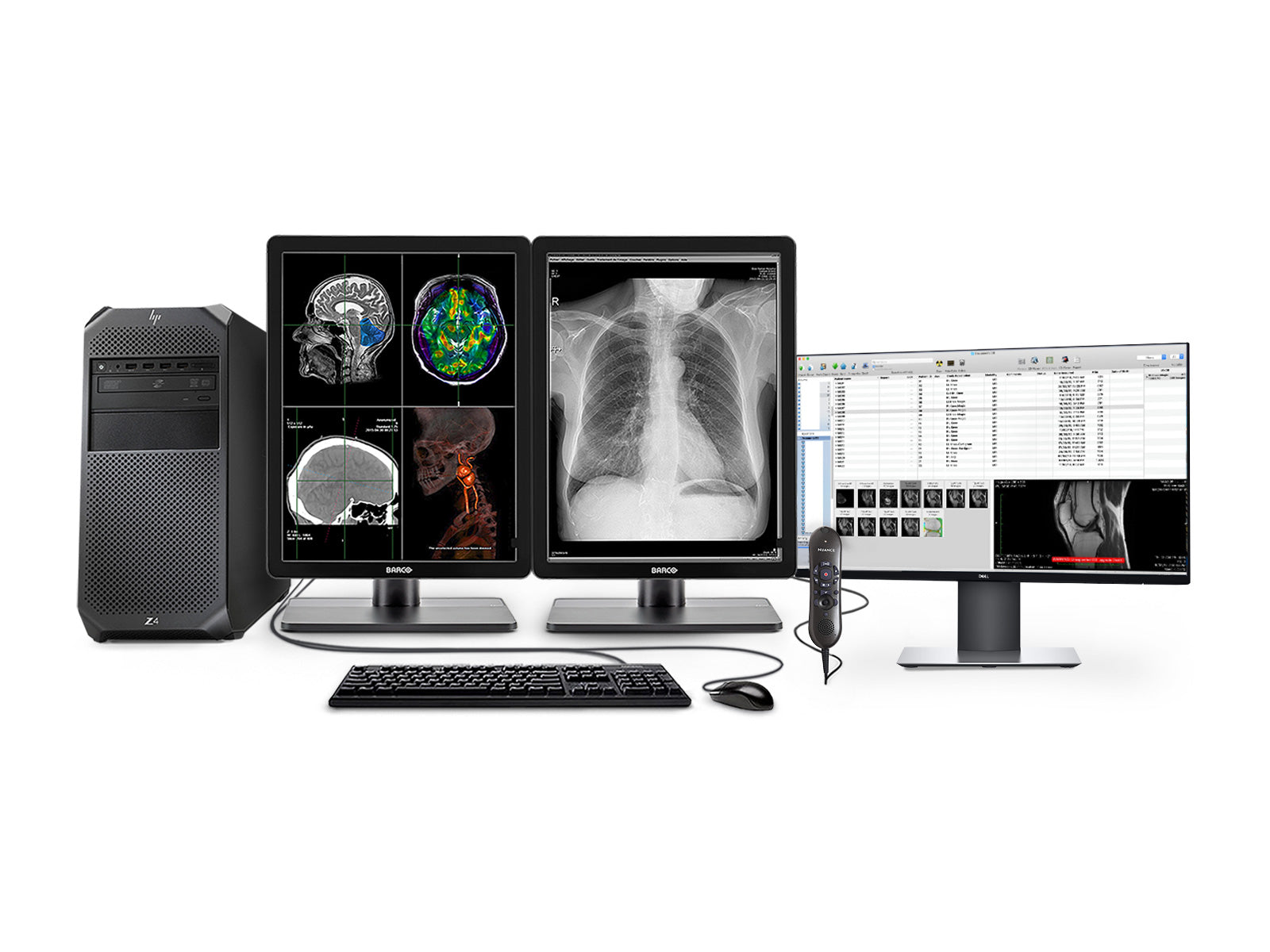 Complete PACS General Radiology Station | Barco Display HP Workstation