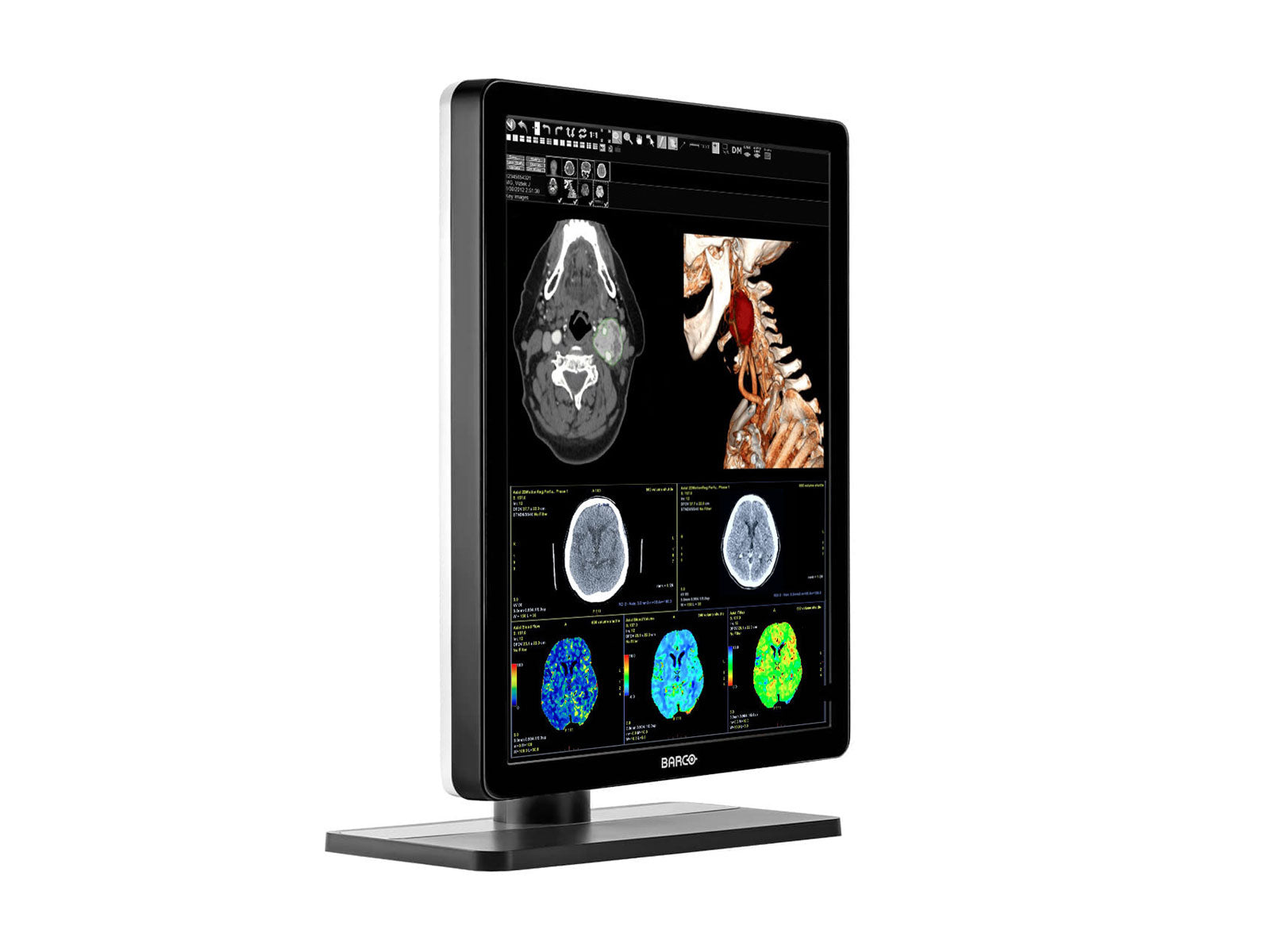 Barco Nio MDNC-3421 3MP 21" Color LED General Radiology PACS Display