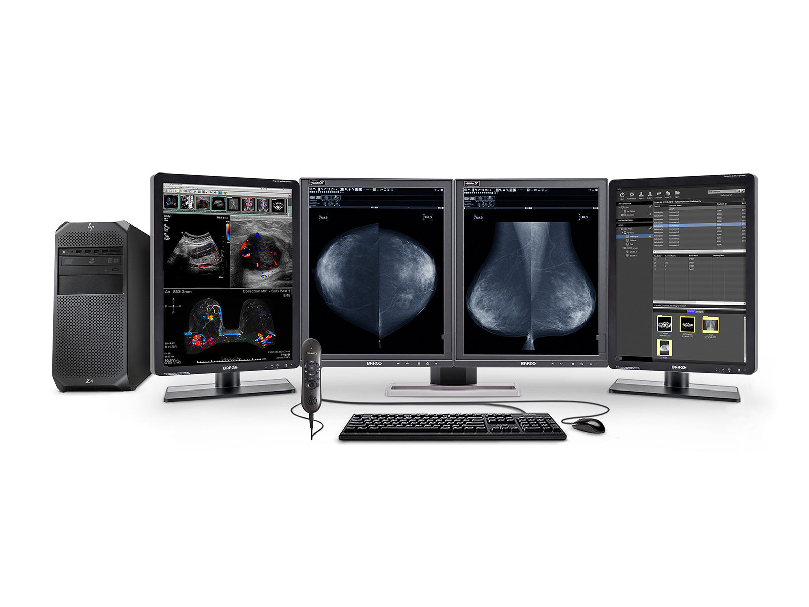 Complete Mammography Reading Station | HP Workstation