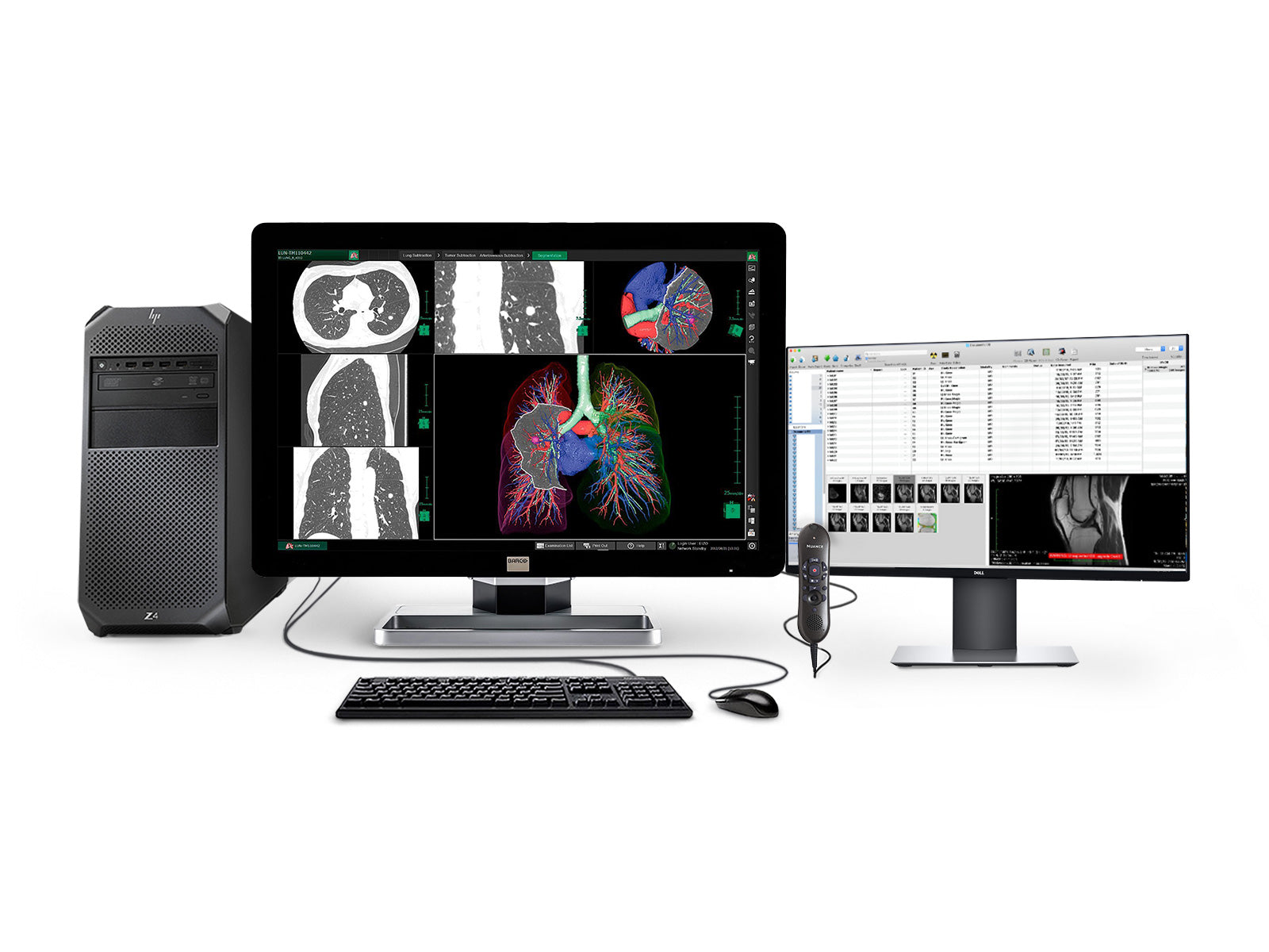 Barco Complete PACS General Radiology Station | HP Workstation