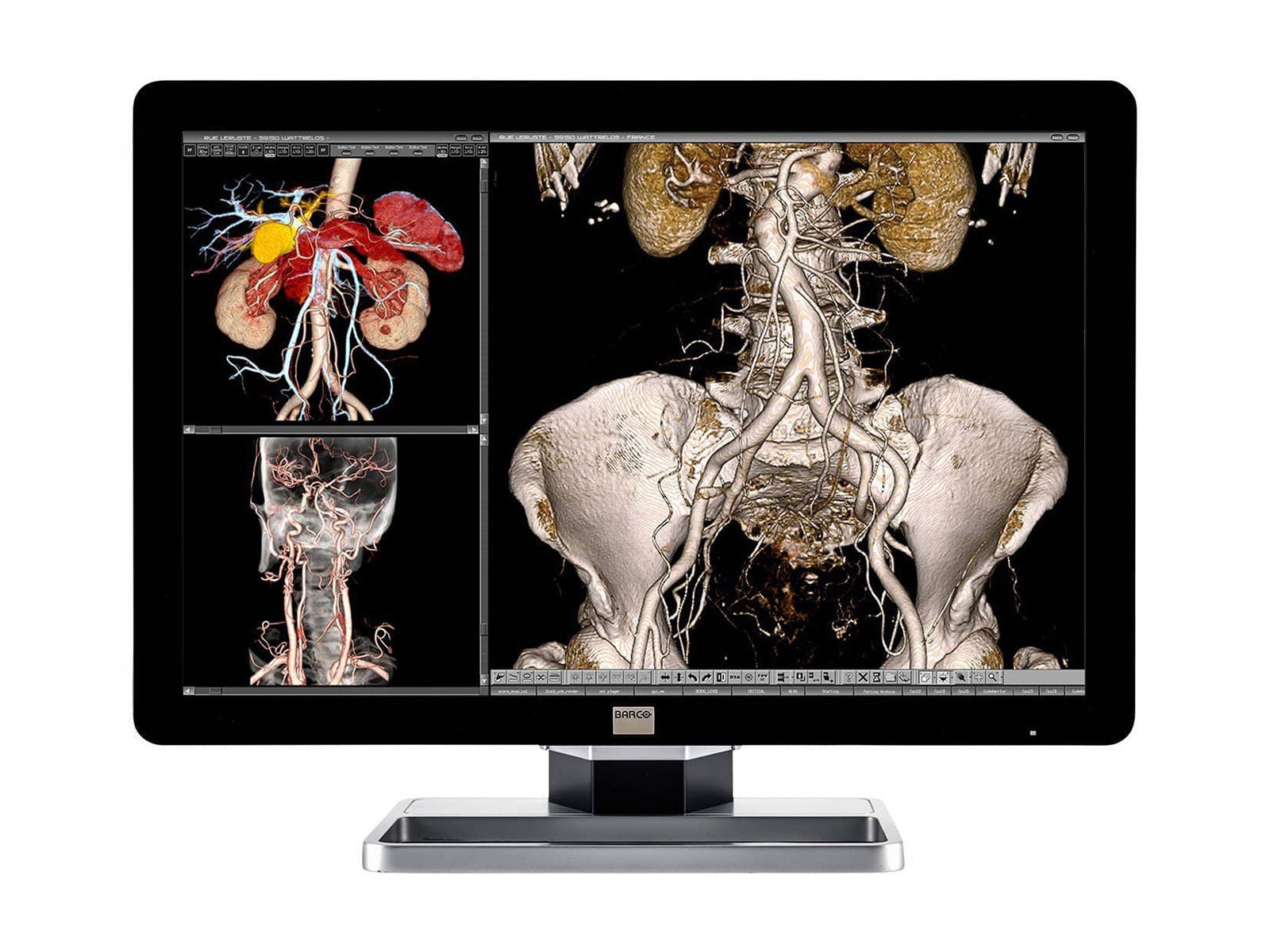 Barco Coronis Fusion MDCC-6230 6MP 30" Color LED General Radiology PACS Display Monitors.com 