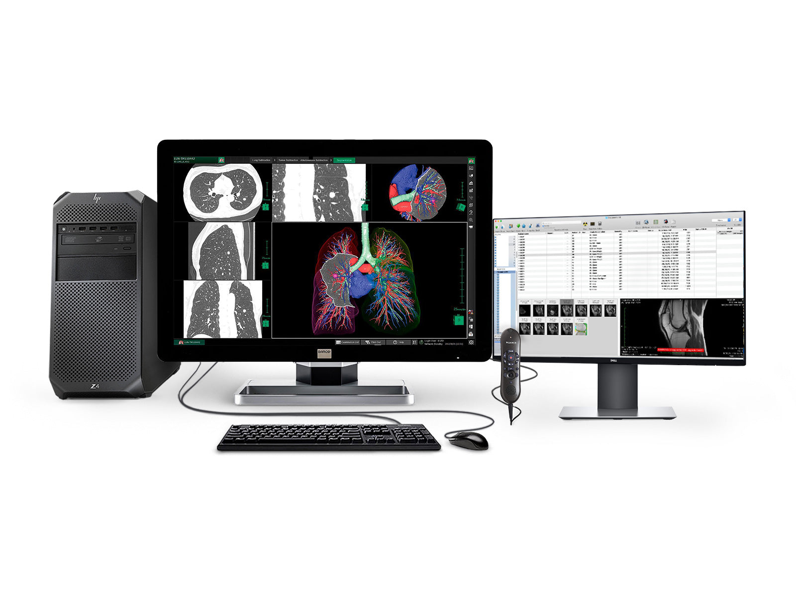 Complete PACS General Radiology Station | HP Workstation