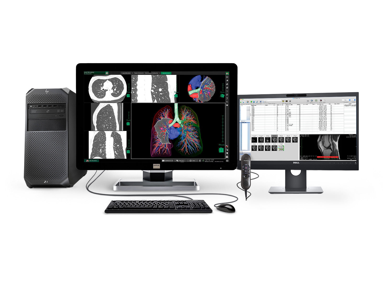 Complete PACS General Radiology Station | HP Workstation