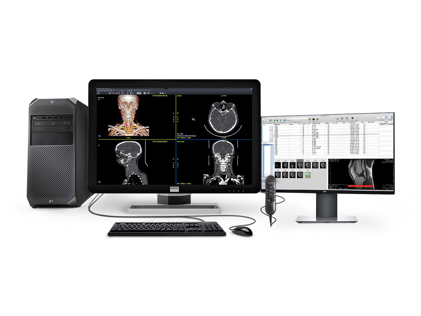 Barco Complete PACS General Radiology Station | HP Workstation