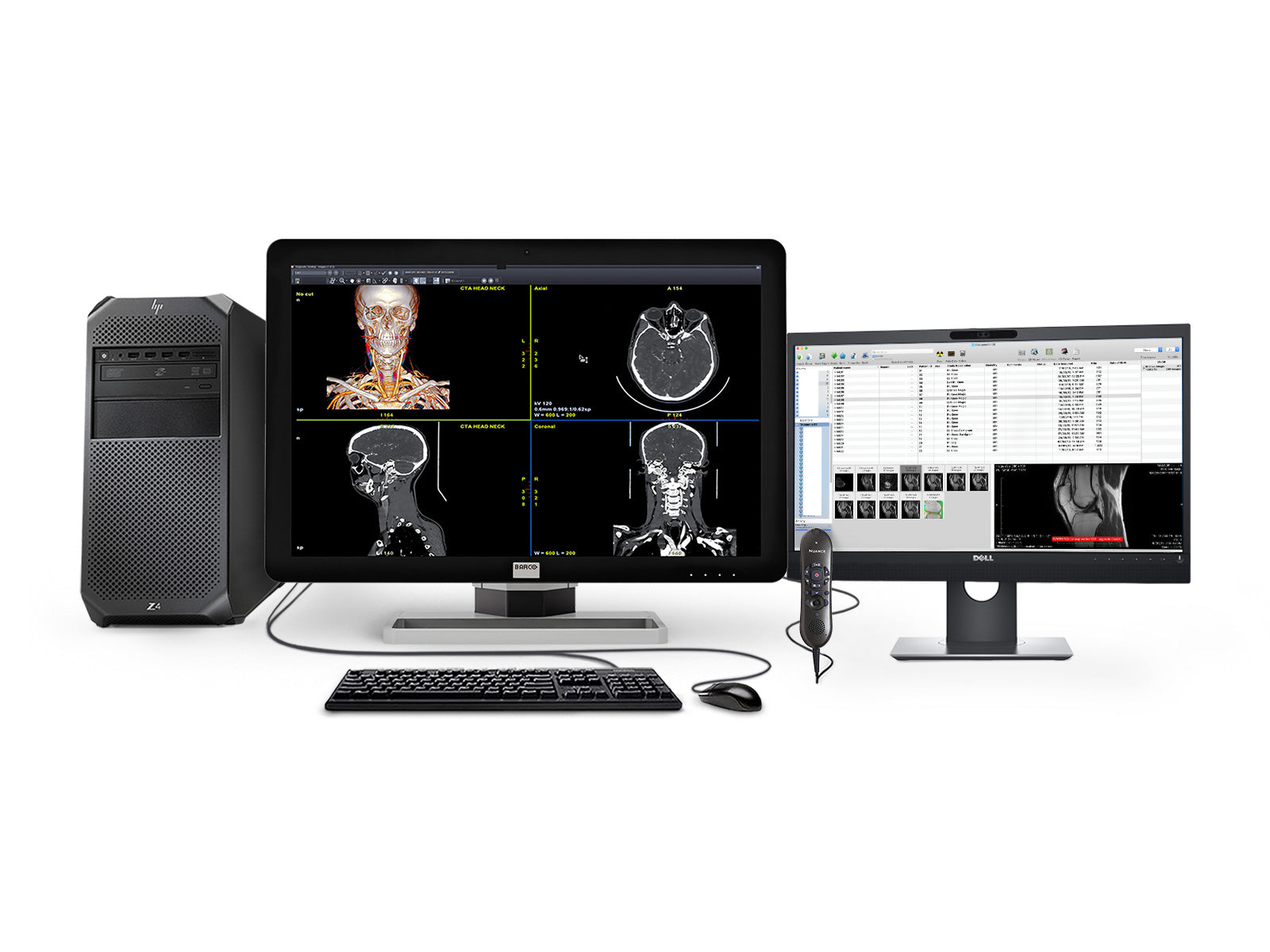 Barco General Radiology Reading Station | 코로 니스 6MP MDCC-6430 | HP 워크 스테이션 | 뉘앙스 마이크 | 24 "워크리스트 모니터 (6430Z4R)