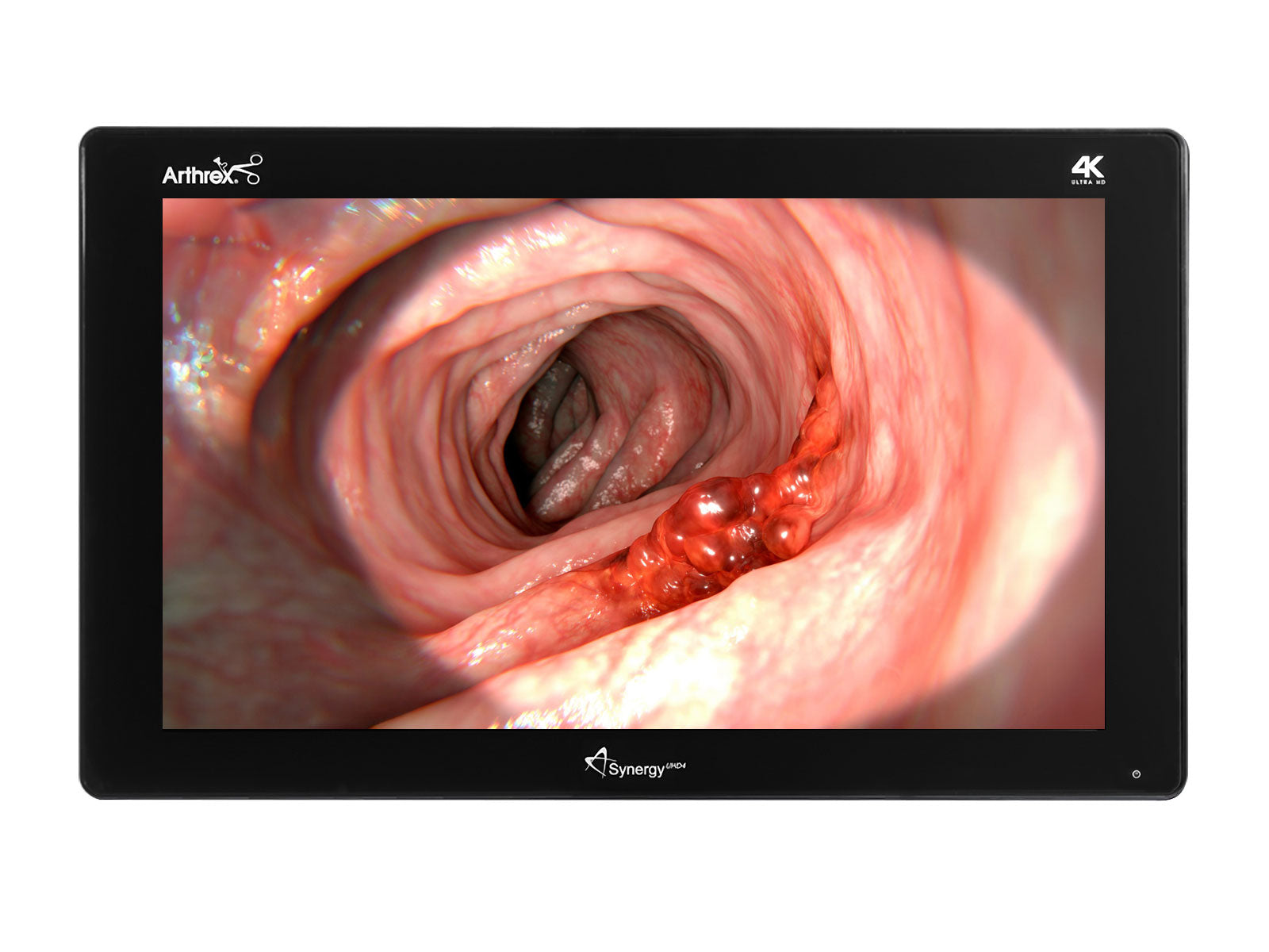 Barco Arthrex SynergyUHD4 32" 4K Color Surgical Medical Display Monitor (AR-3250-3210)