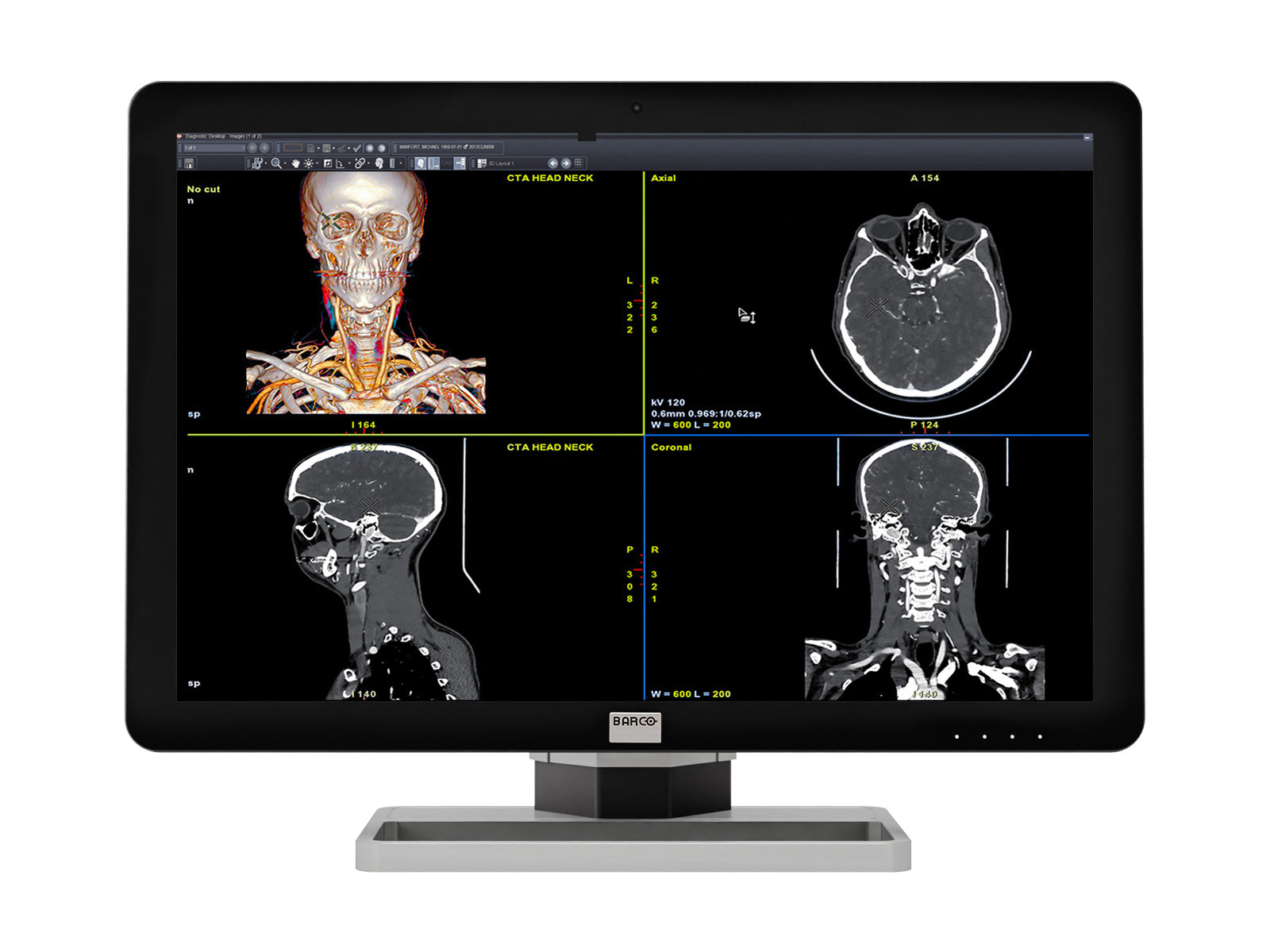 Barco Coronis Fusion MDCC-6430 6MP 30" Color LED General Radiology PACS Display