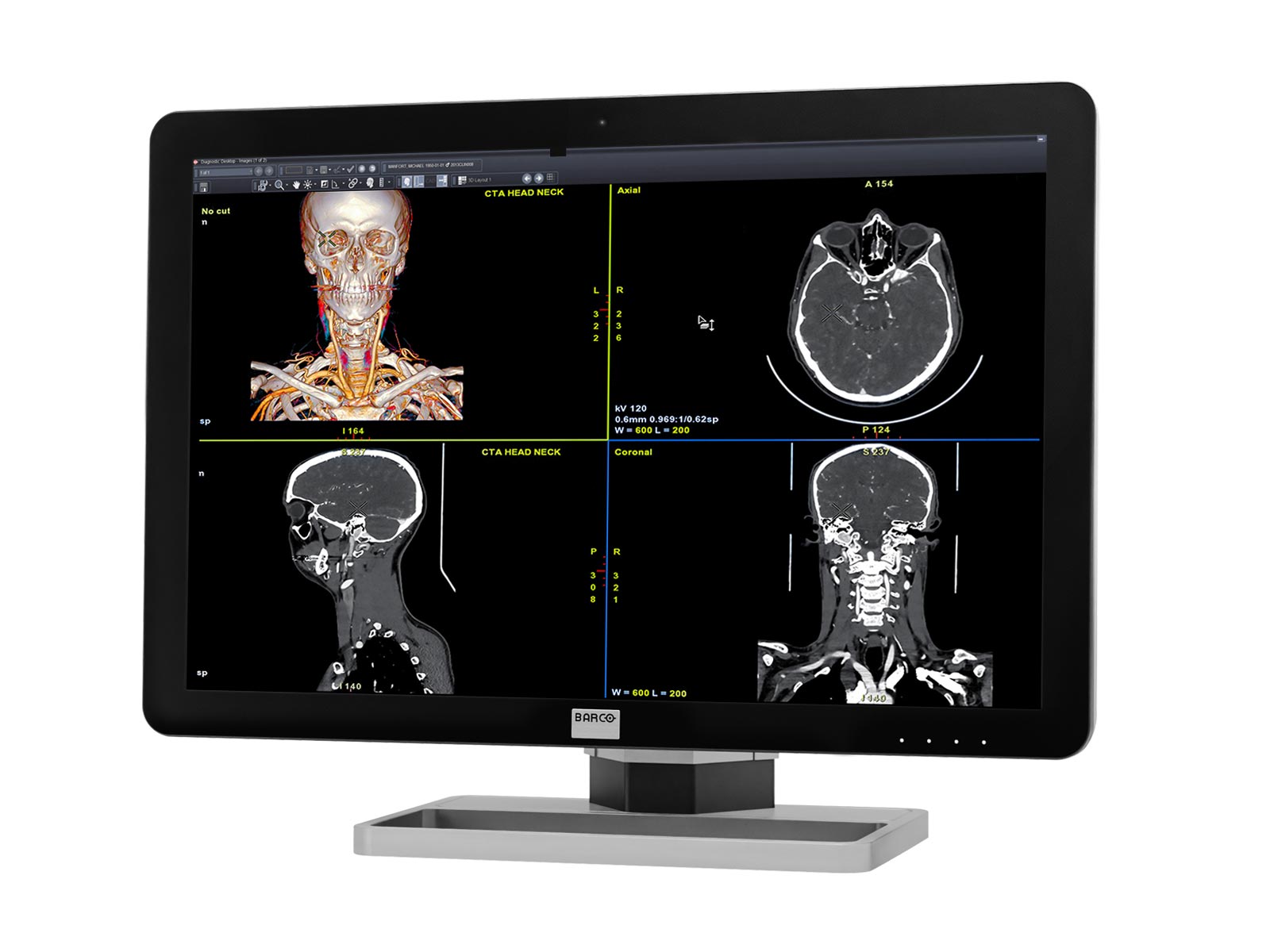 Barco Coronis Fusion MDCC-6430 6MP 30" Color LED General Radiology PACS Display