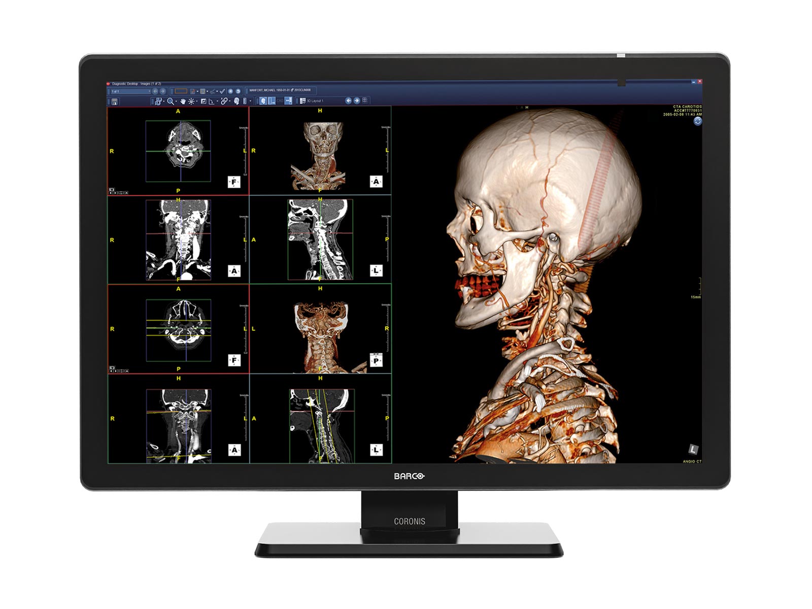 Complete PACS General Radiology Station | Barco 6MP Color LED Display | Lenovo Workstation | Dictation Mic | Worklist Monitor (6530Z4R)