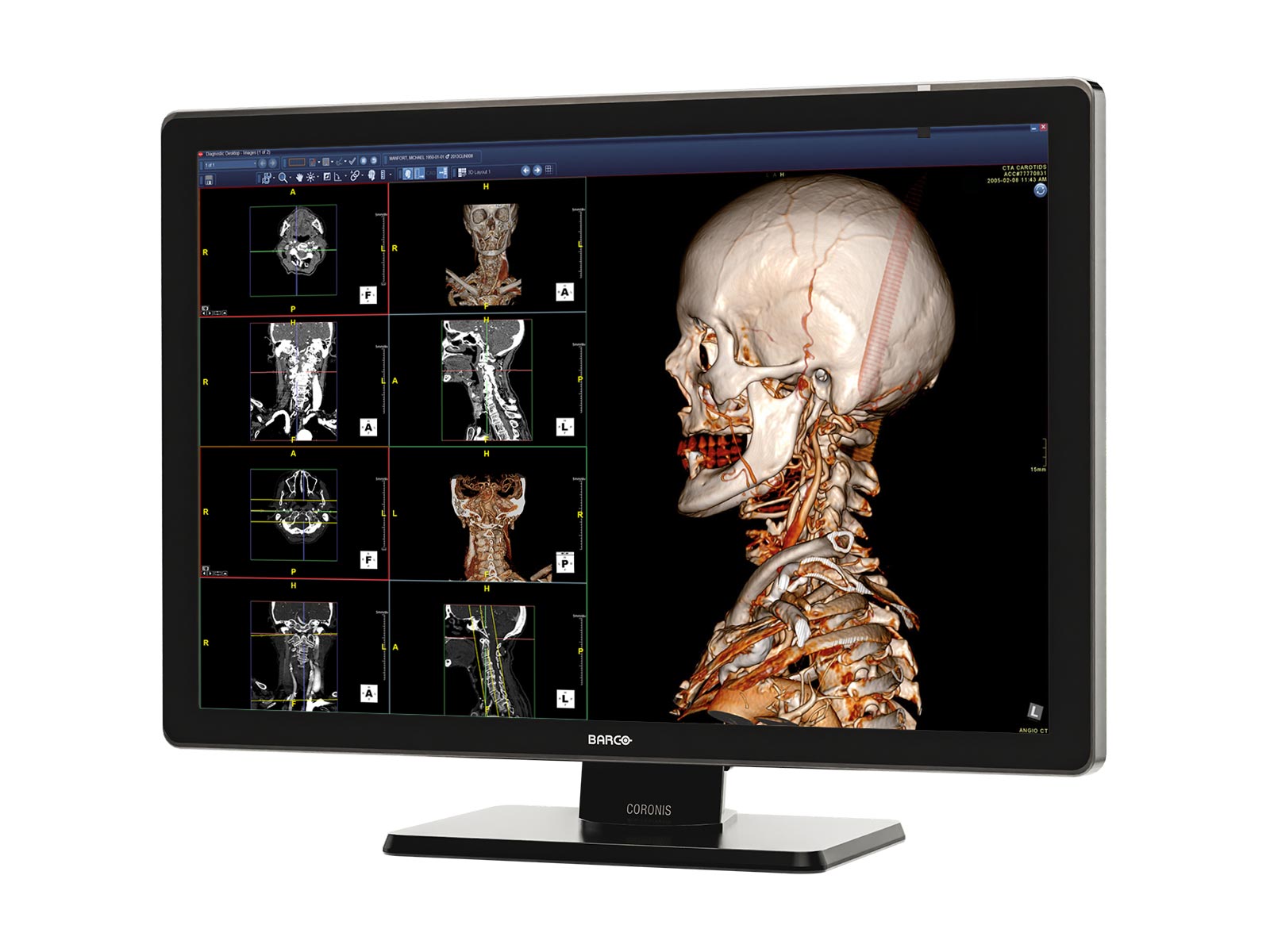 Barco Coronis Fusion MDCC-6530 6MP 30" Color Medical Diagnostic Radiology Monitor (Copy) Monitors.com 