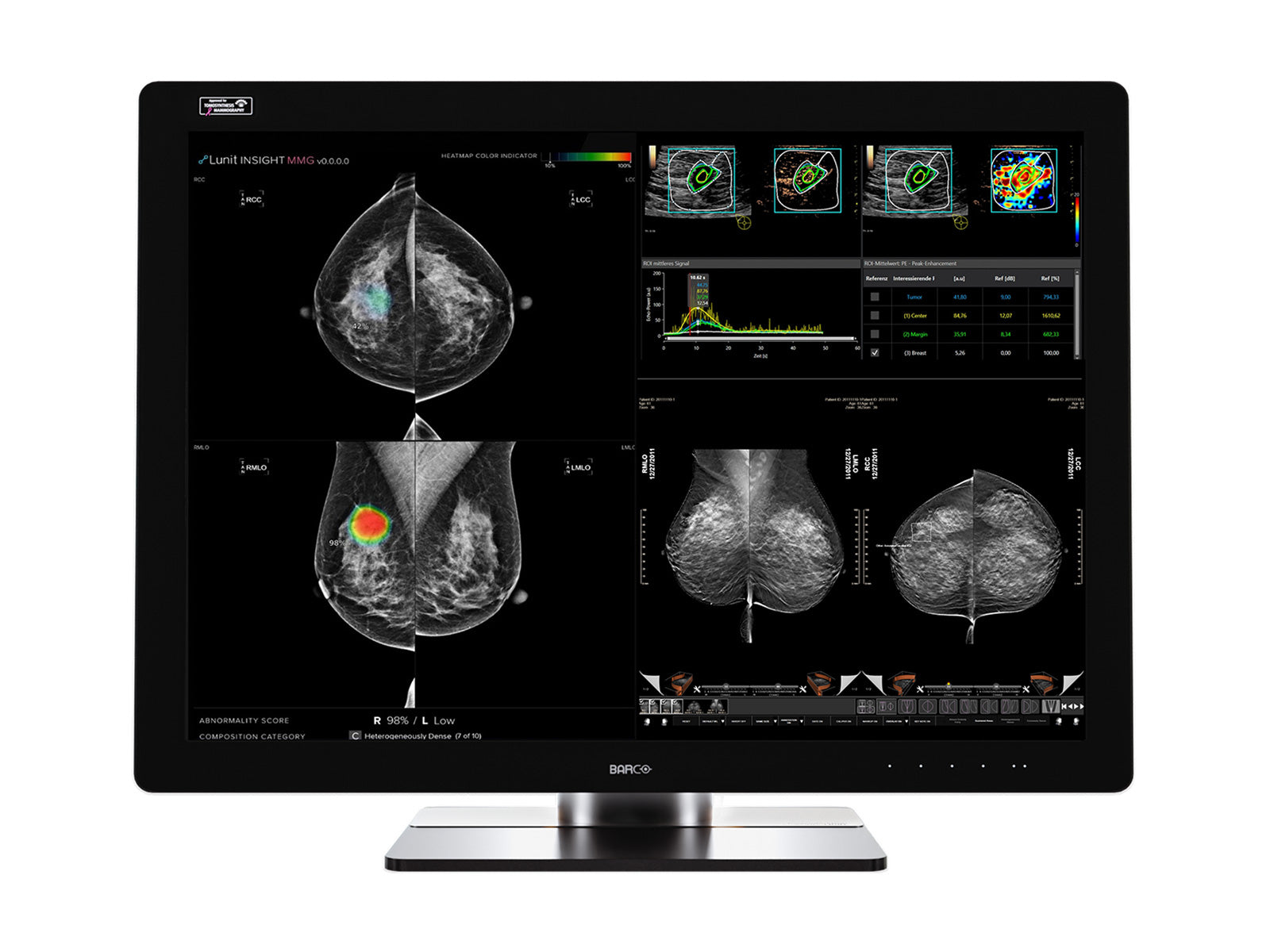 Complete Mammography Reading Station | Barco Coronis UNITI | HP Z4 G5 Workstation | Dictation Mic | Worklist Monitors (12133Z4G5R) Monitors.com 