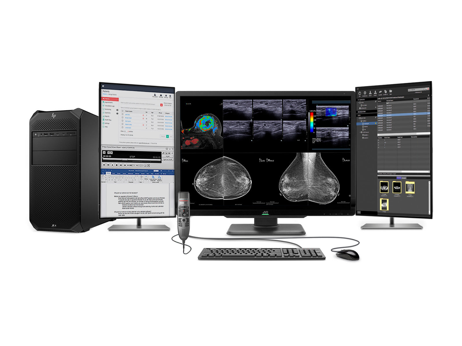 Complete Mammography Reading Station | JVC Totoku | Lenovo Workstation