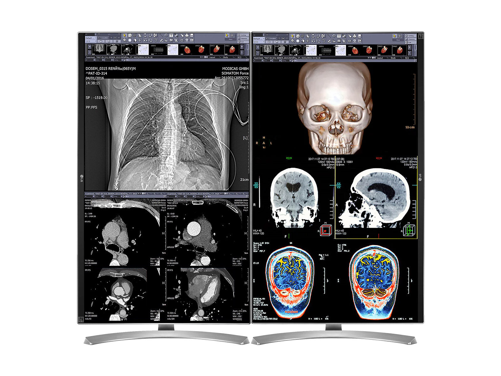 Complete Clinical Review Reading Station | 2 x LG 27" 8MP Color Clinical Review Displays | HP ZBook Studio 16 G10 | Dictation Mic | PerfectLUM Calibration Package (LGHP16G10)