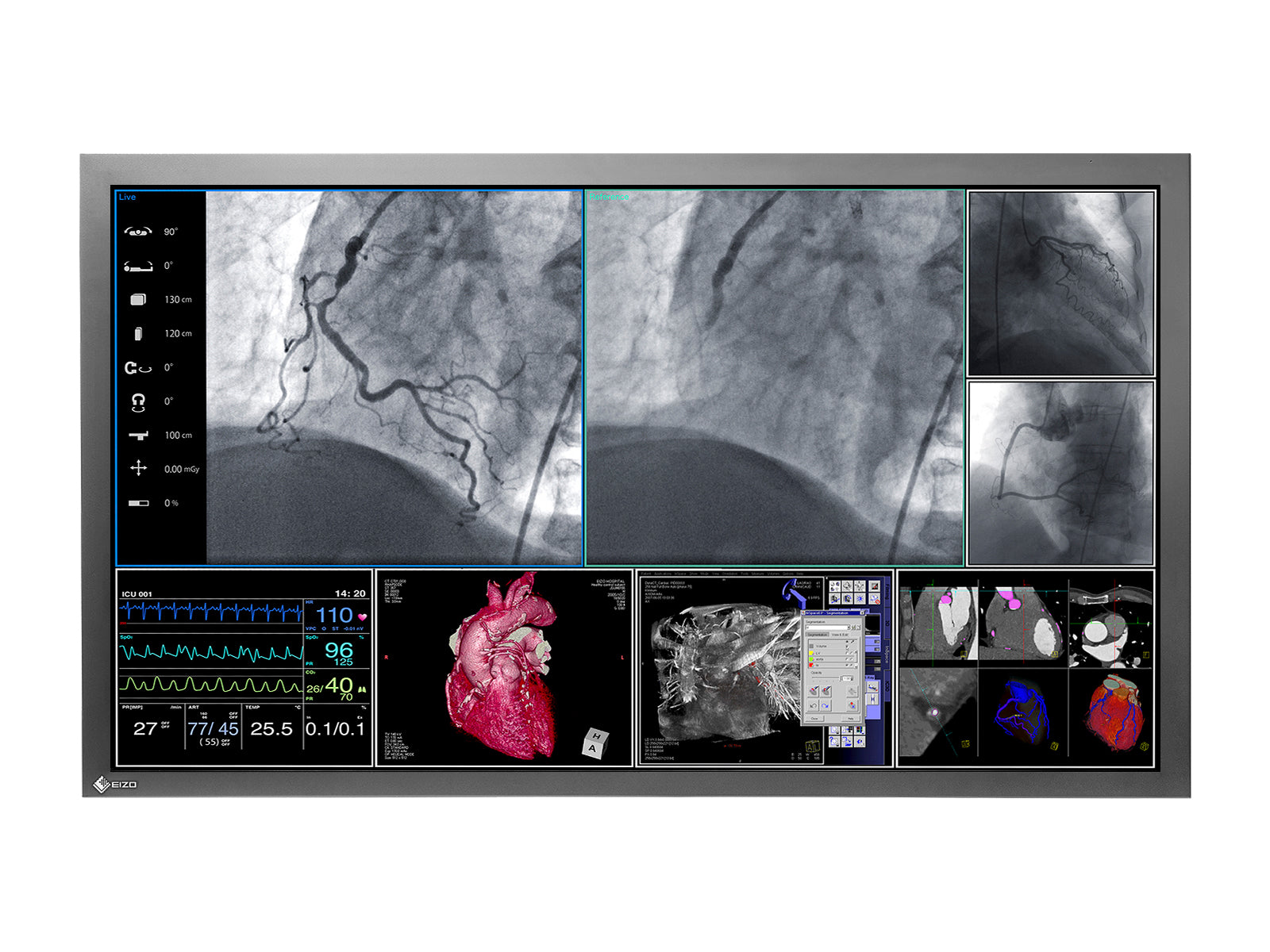 Eizo RadiForce LS560W 56" 8MP 4K Color Surgical Medical Display Monitor (LS560W) Monitors.com 