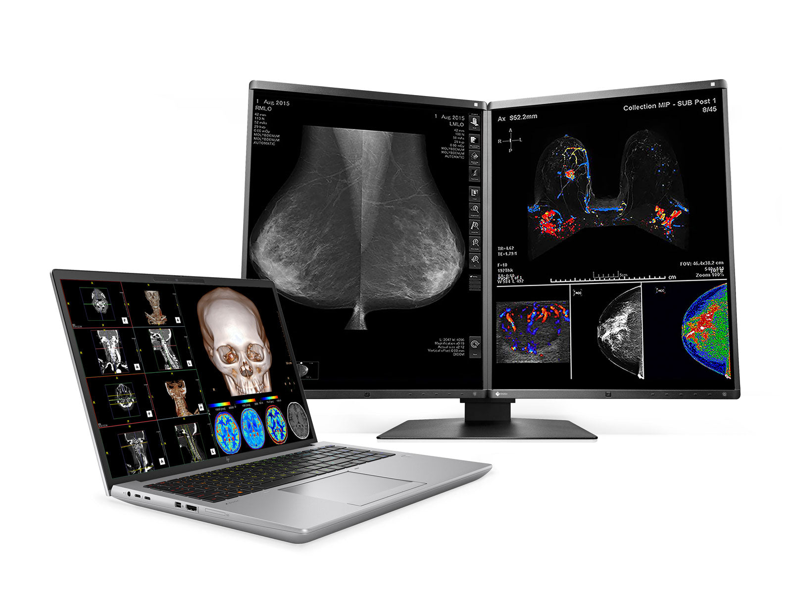 Estación de trabajo de radiología móvil HP ZBook Fury 16 G10 | DICOM UHD 4K+ de 16" y 9MP calibrado | Núcleo i7-13850HX @ 5.30GHz | 20 núcleos | DDR5 de 32 GB | SSD NVMe de 1 TB | RTX 2000 Ada 8GB | WiFi 6E | Win10-11 A favor