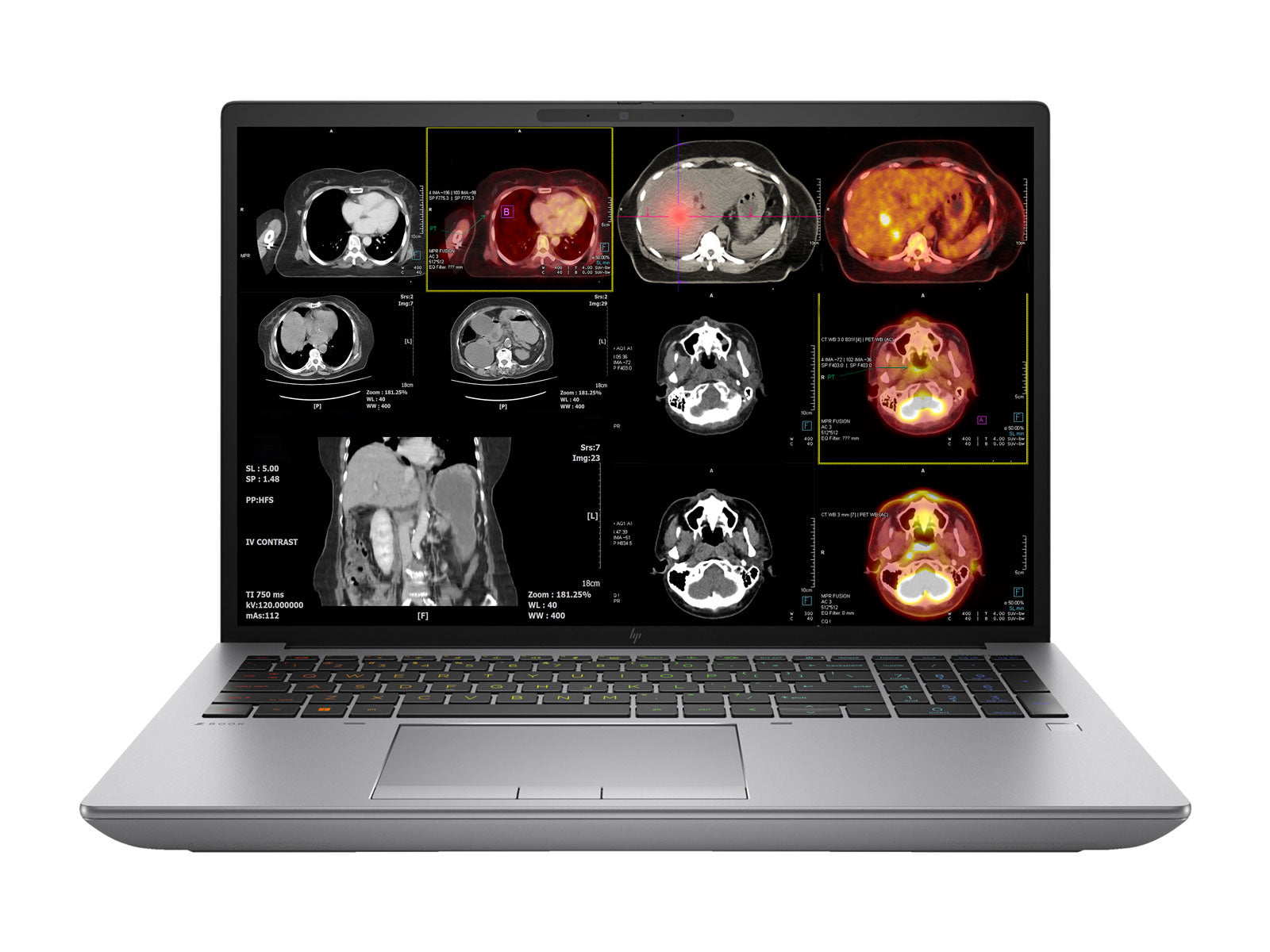 HP ZBook Fury 16 G10 Mobile Radiology Workstation | 16" 8MP 4K UHD DICOM Calibrated | Core i9-13950HX @ 5.5GHz | 128GB DDR5 | 2TB NVMe SSD | RTX 5000 Ada 16GB | WiFi 6E