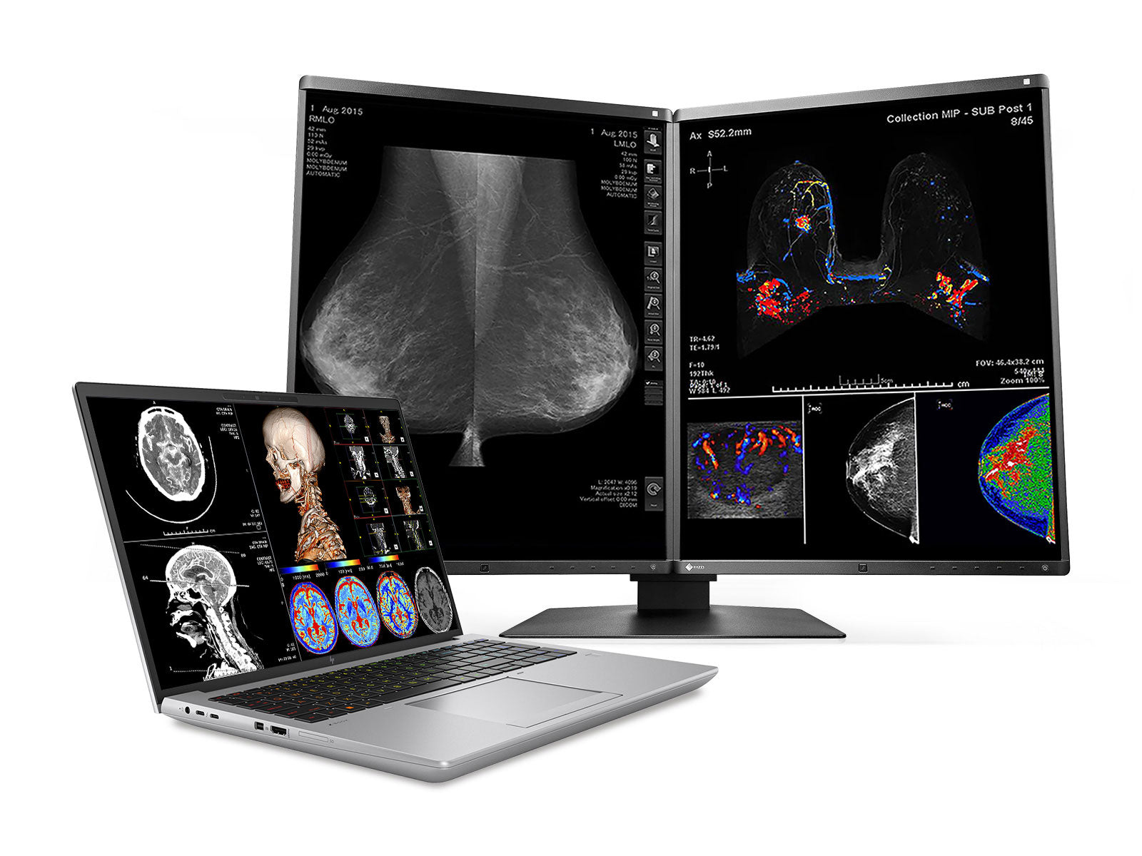 HP ZBook Fury 16 G9 Mobile Radiology Workstation | 16" WUXGA DICOM Calibrated | Core i7-12800HX @ 4.80GHz | 16-core | 128GB DDR5 | 1TB NVMe SSD | Radeon Pro W6600M 8GB | WiFi 6