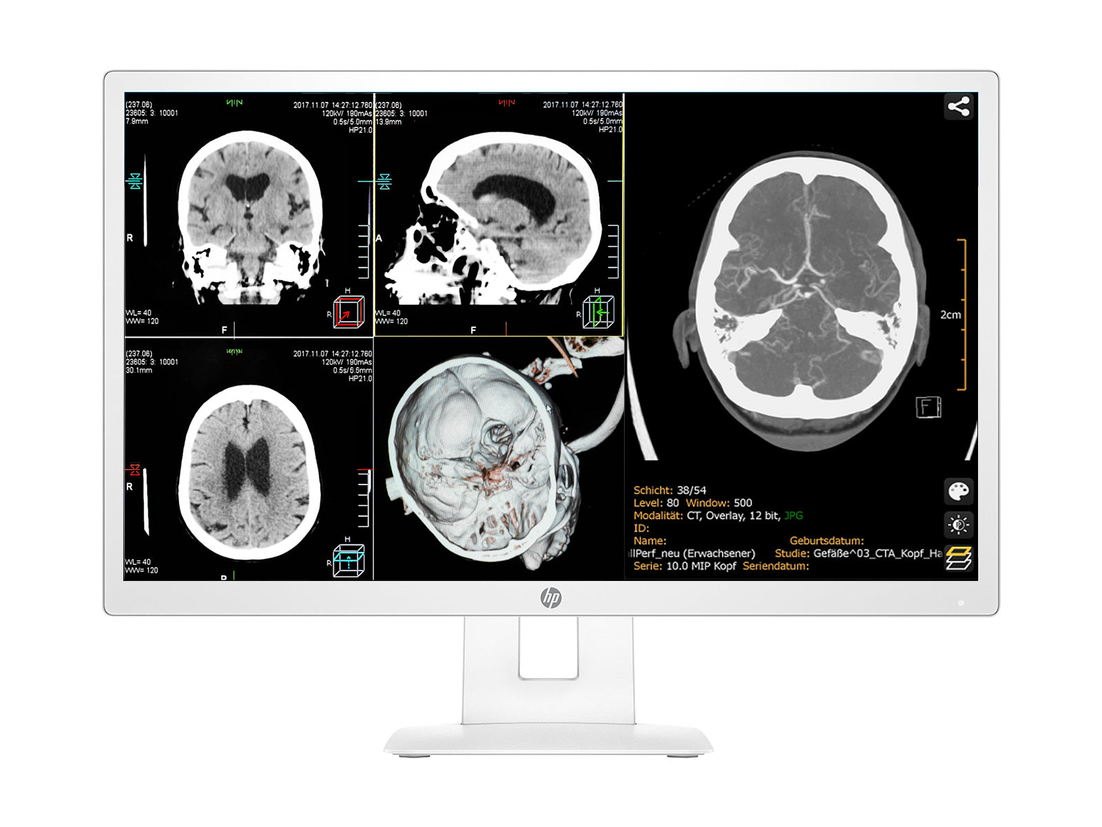 HP 27" 3MP DICOM Clinical Review Medical Display Monitor Monitors.com 