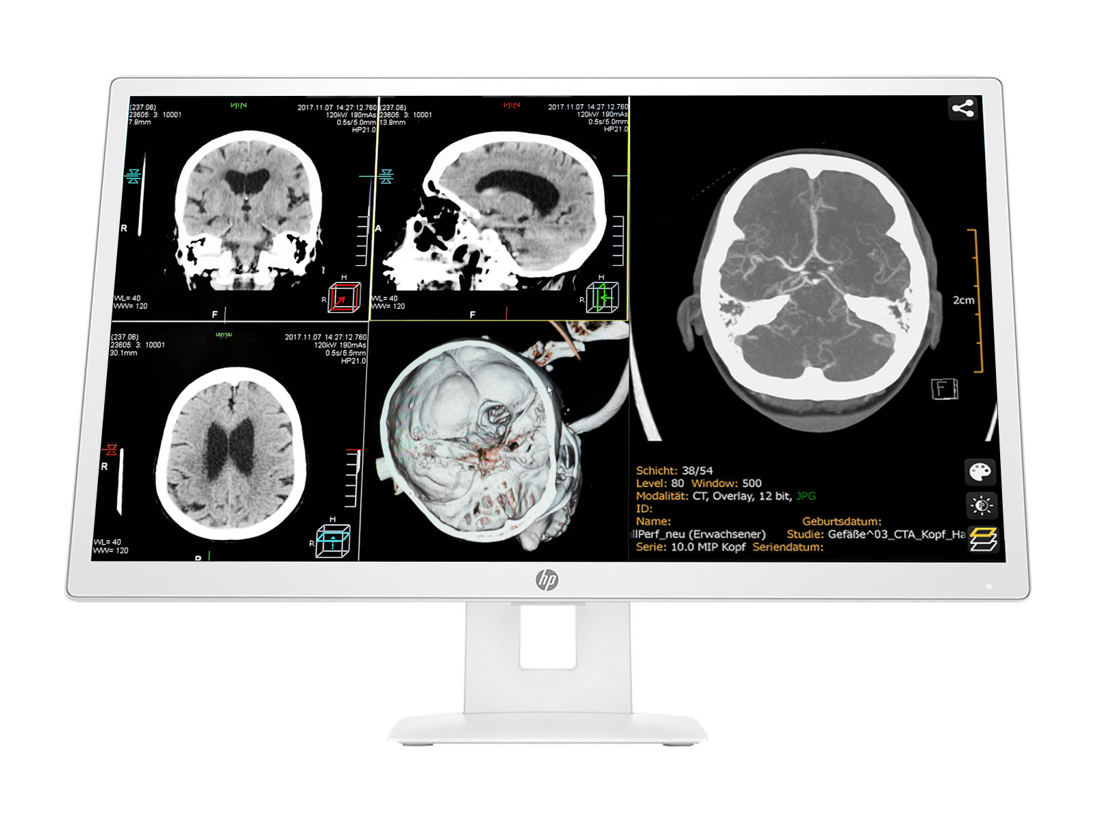 HP 27" 3MP DICOM Clinical Review Medical Display Monitor Monitors.com 