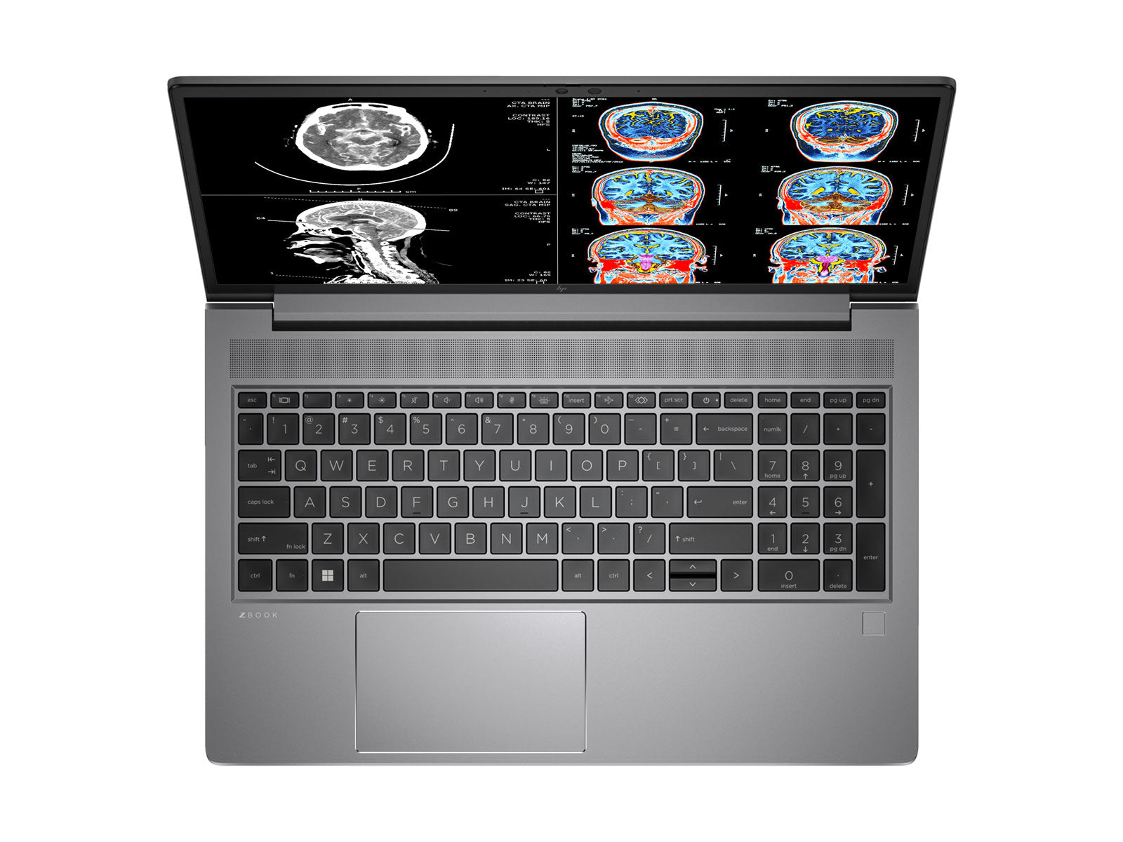 HP ZBook Power 15 G9 Mobile Radiology Workstation | 15.6" UHD 8MP+ DICOM Calibrated | Core i7-12700H @ 4.70GHz | 32GB DDR5 | 512GB NVMe SSD | NVIDIA RTX A2000 8GB | Win11 Pro Monitors.com 