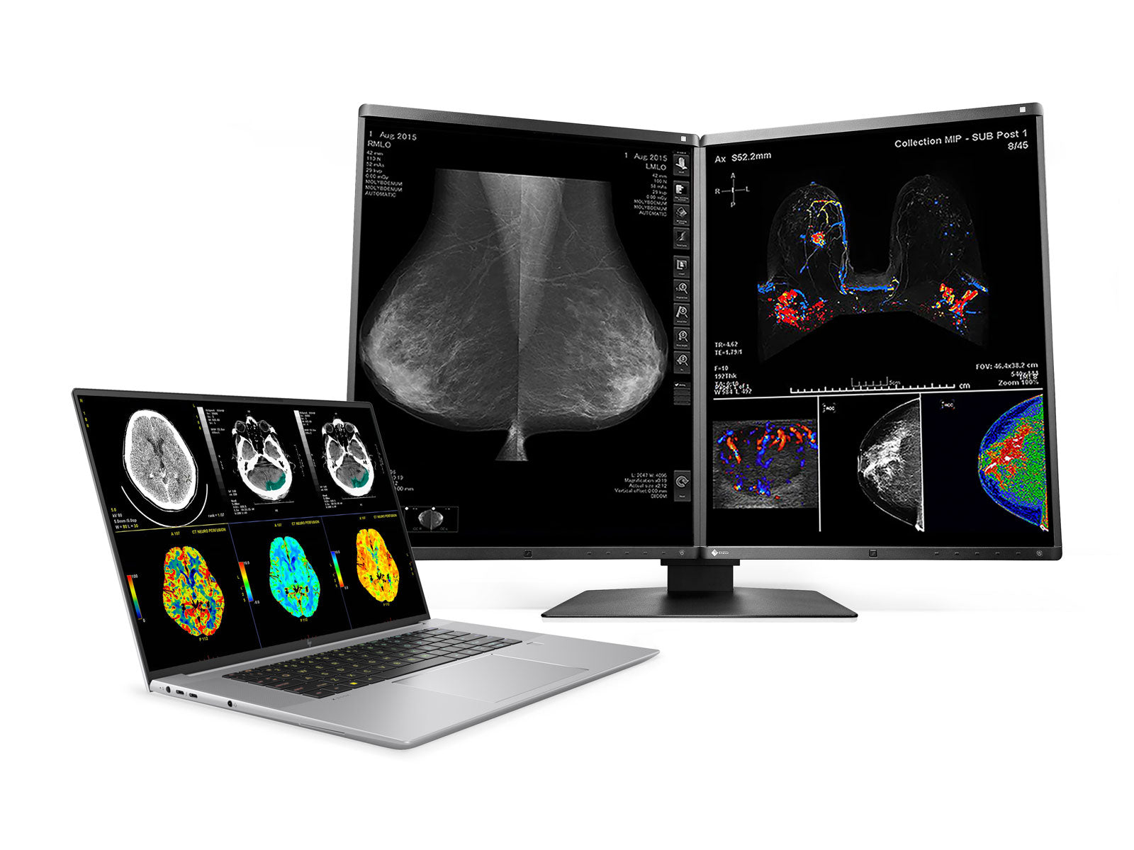 HP ZBook Studio 16 G10 Mobile Radiology Workstation | 16" WUXGA DICOM Calibrated | Core i9-13900H @ 5.4GHz | 64GB DDR5 | 1TB NVMe SSD | NVIDIA RTX 4070 8GB | WiFi 6E