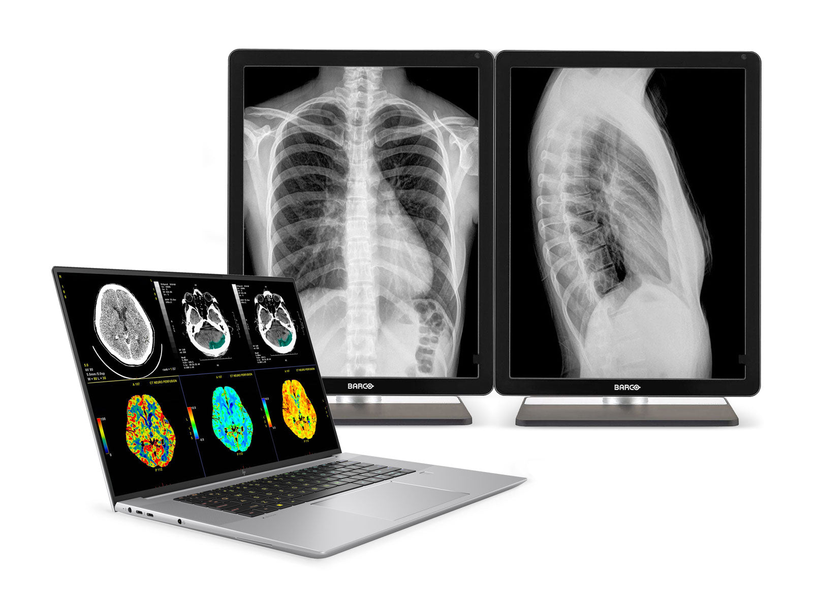 HP ZBook Studio 16 G10 Mobile Radiology Workstation | 16" WUXGA DICOM Calibrated | Core i9-13900H @ 5.4GHz | 64GB DDR5 | 1TB NVMe SSD | NVIDIA RTX 4070 8GB | WiFi 6E